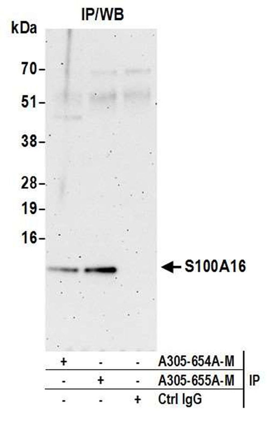 Detection of human S100A16 by WB of IP.