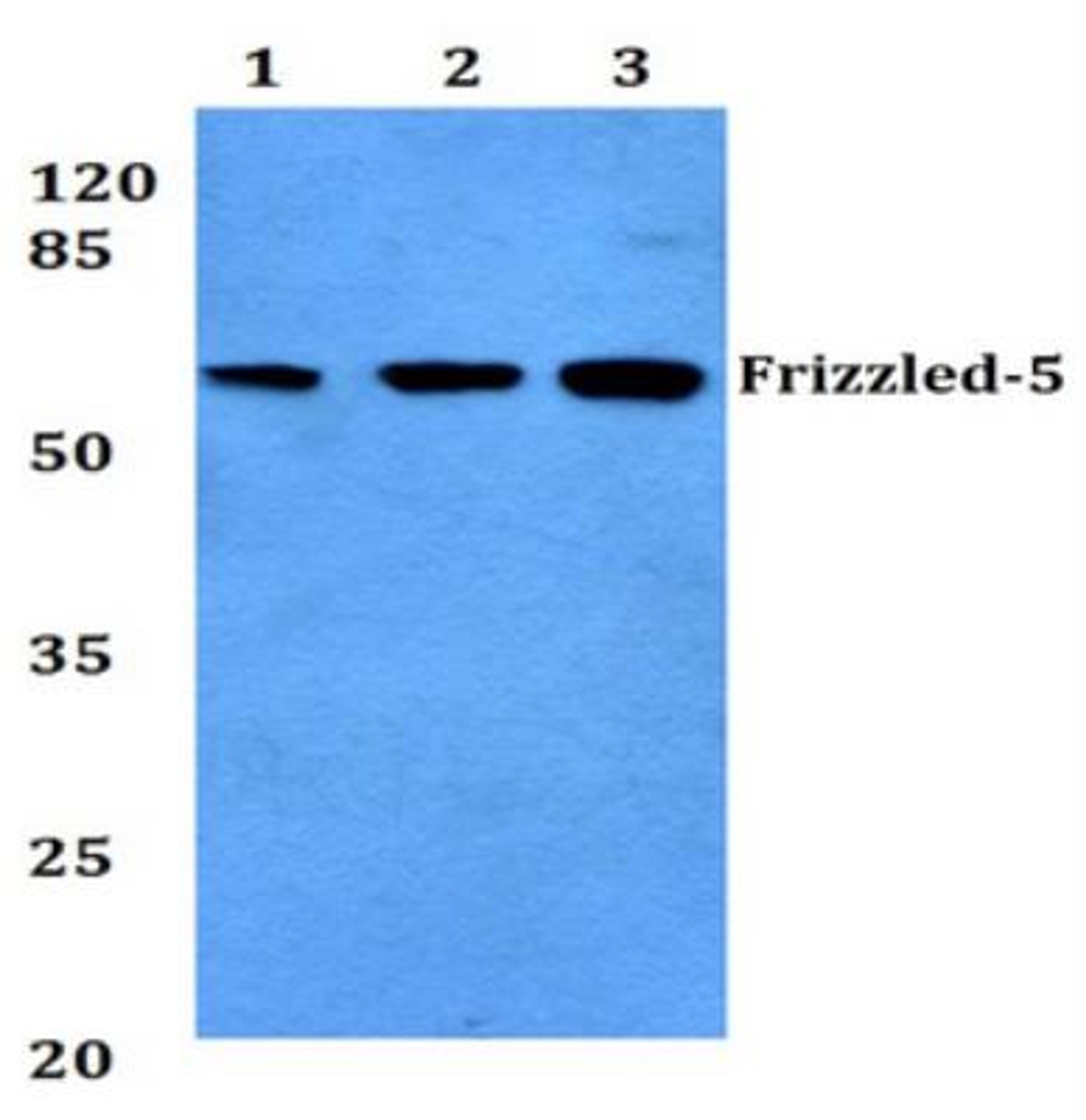 Western Blot: Frizzled-5 Antibody [NBP1-00830] - Lane1:Hela whole cell lysate.  Lane2:NIH-3T3 whole cell lysate. Lane3:H9C2 whole cell lysate.