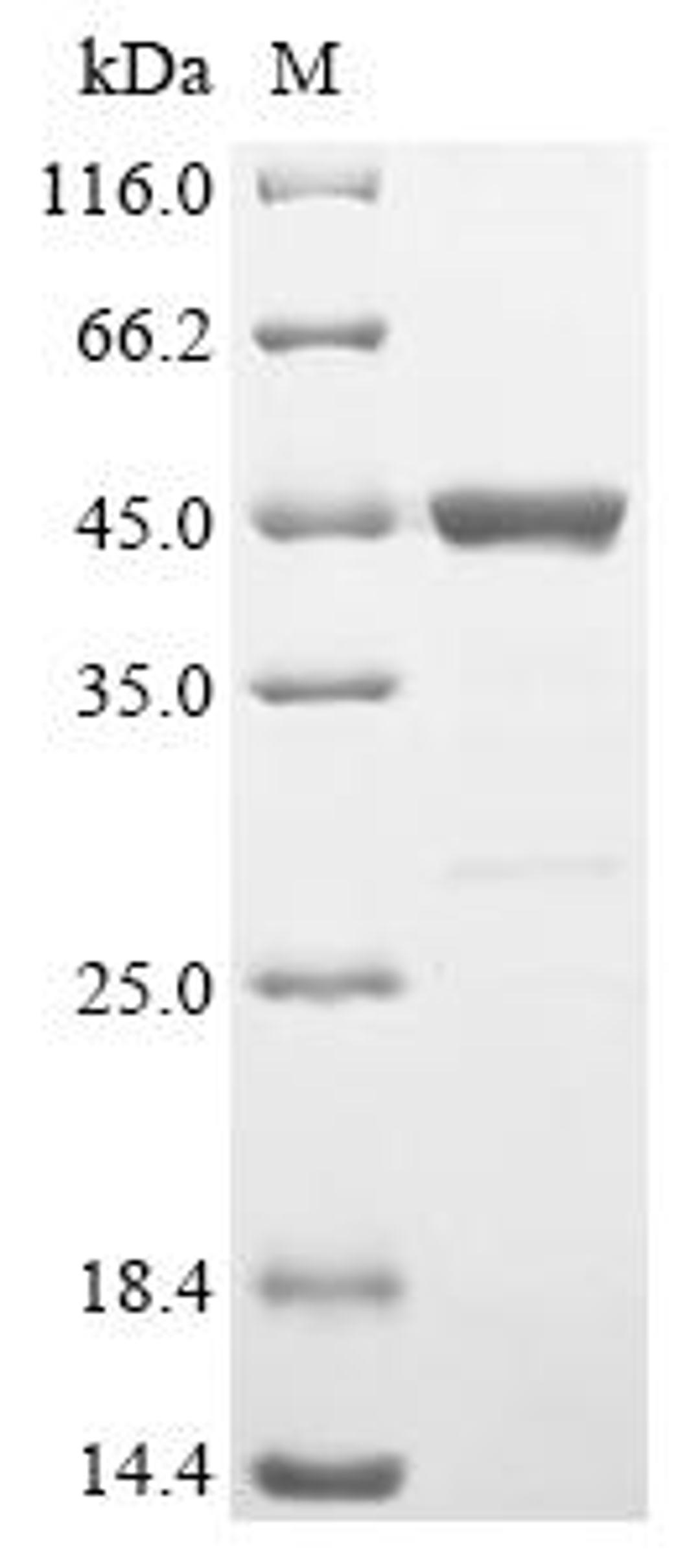 (Tris-Glycine gel) Discontinuous SDS-PAGE (reduced) with 5% enrichment gel and 15% separation gel.