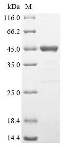 (Tris-Glycine gel) Discontinuous SDS-PAGE (reduced) with 5% enrichment gel and 15% separation gel.