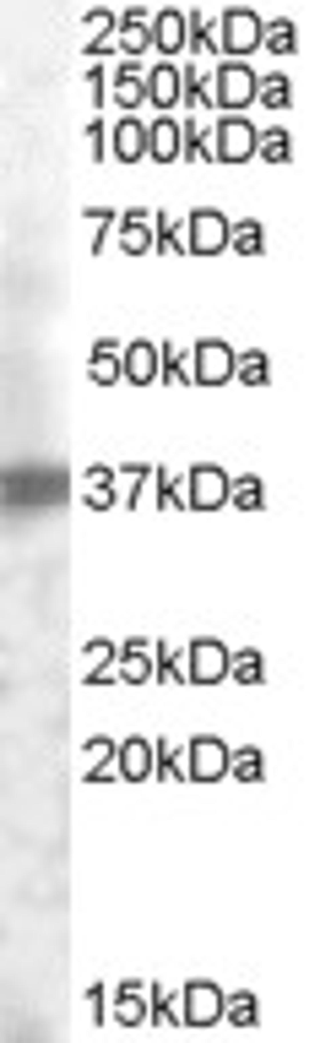 46-736 (0.2ug/ml) staining of Human Prostate lysate (35ug protein in RIPA buffer). Primary incubation was 1 hour. Detected by chemiluminescence.