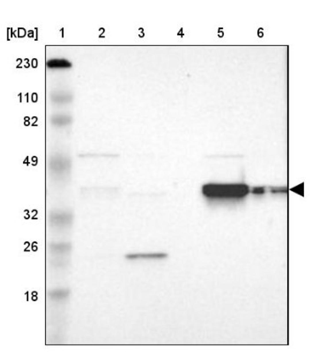 Western Blot: FAM50A Antibody [NBP1-89344] - Lane 1: Marker [kDa] 230, 110, 82, 49, 32, 26, 18<br/>Lane 2: Human cell line RT-4<br/>Lane 3: Human cell line U-251MG sp<br/>Lane 4: Human plasma (IgG/HSA depleted)<br/>Lane 5: Human liver tissue<br/>Lane 6: Human tonsil tissue