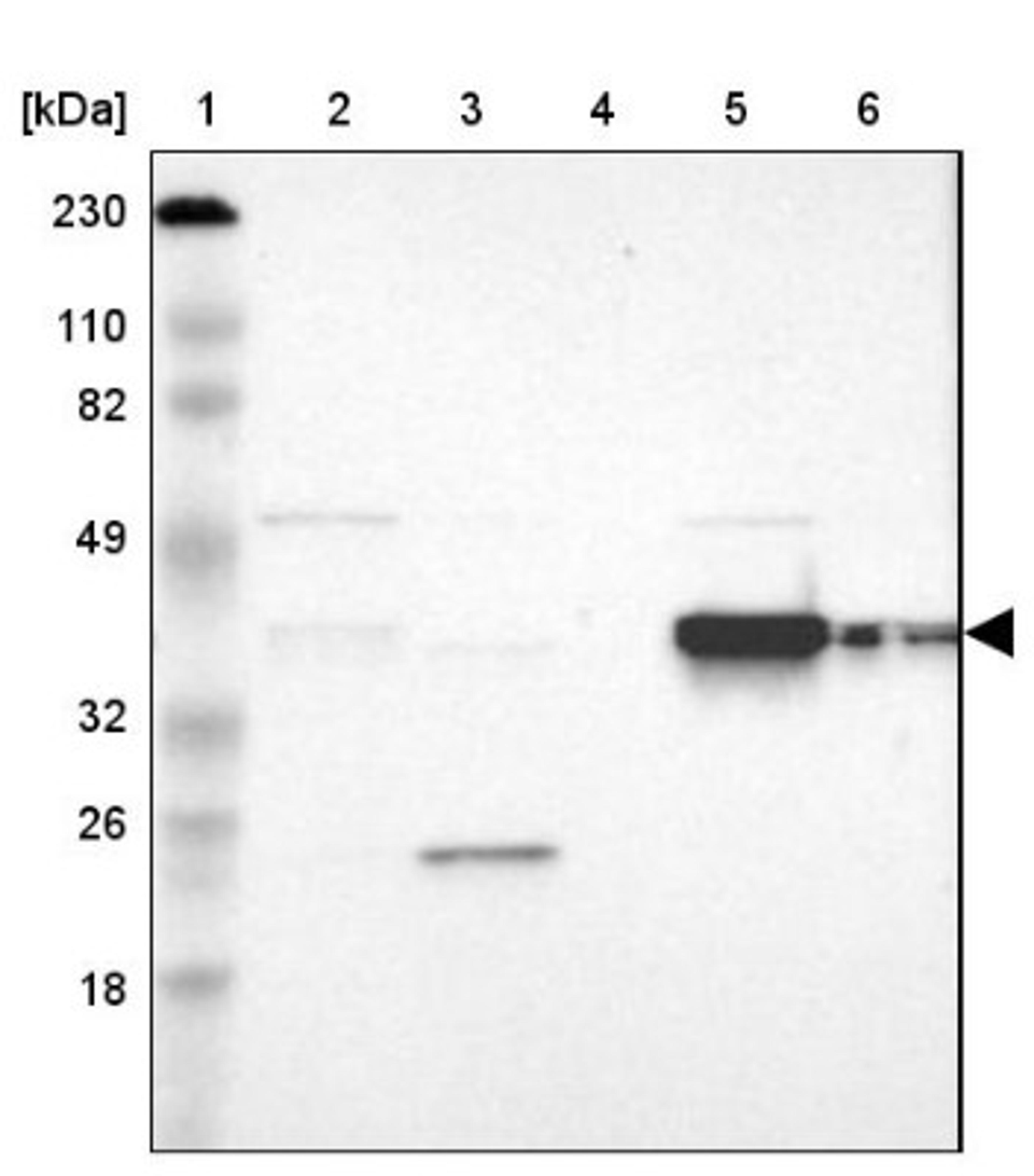 Western Blot: FAM50A Antibody [NBP1-89344] - Lane 1: Marker [kDa] 230, 110, 82, 49, 32, 26, 18<br/>Lane 2: Human cell line RT-4<br/>Lane 3: Human cell line U-251MG sp<br/>Lane 4: Human plasma (IgG/HSA depleted)<br/>Lane 5: Human liver tissue<br/>Lane 6: Human tonsil tissue