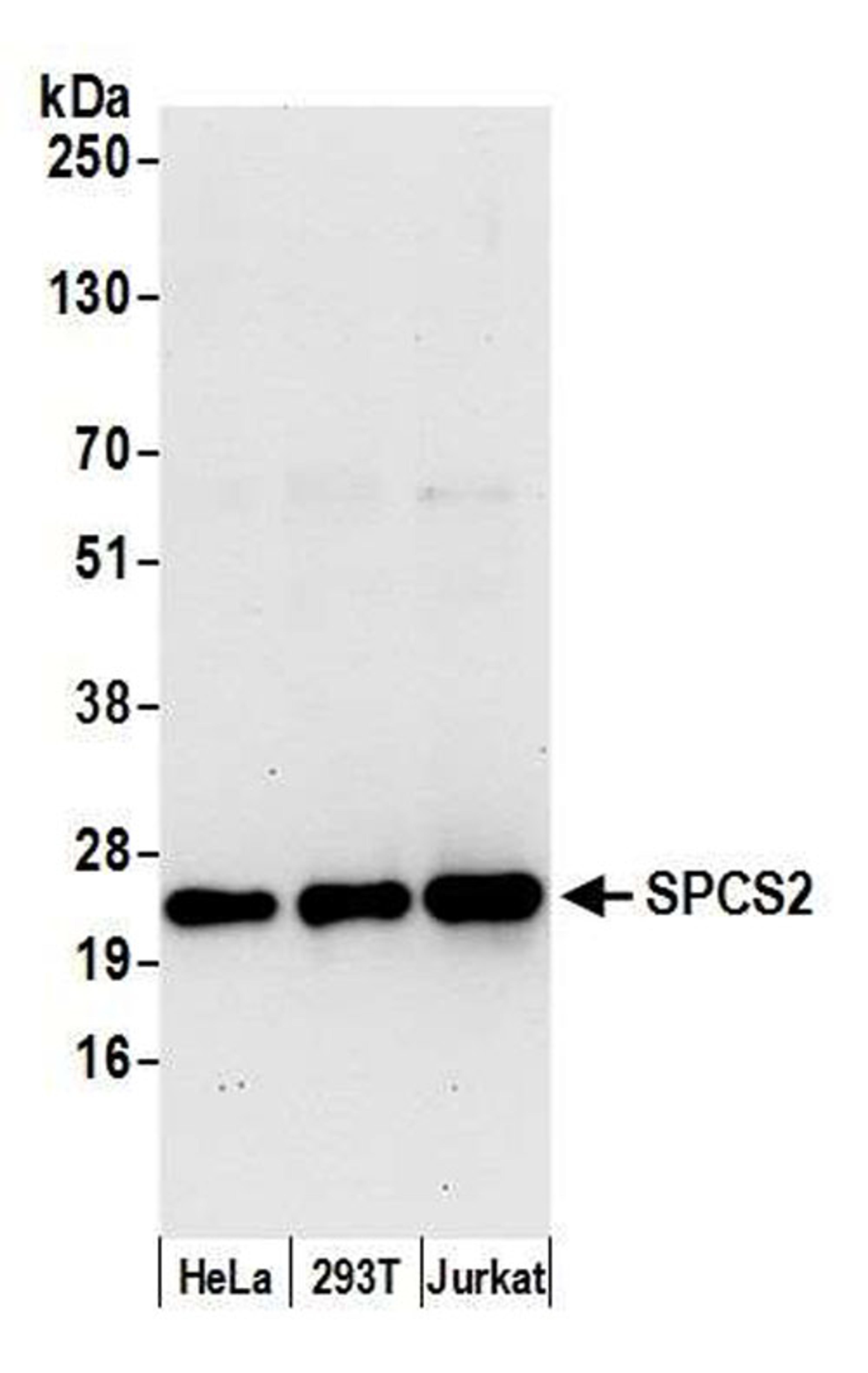 Detection of human SPCS2 by WB.