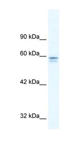 Western blot analysis of HepG2 cell lysate tissue using MTF1 antibody