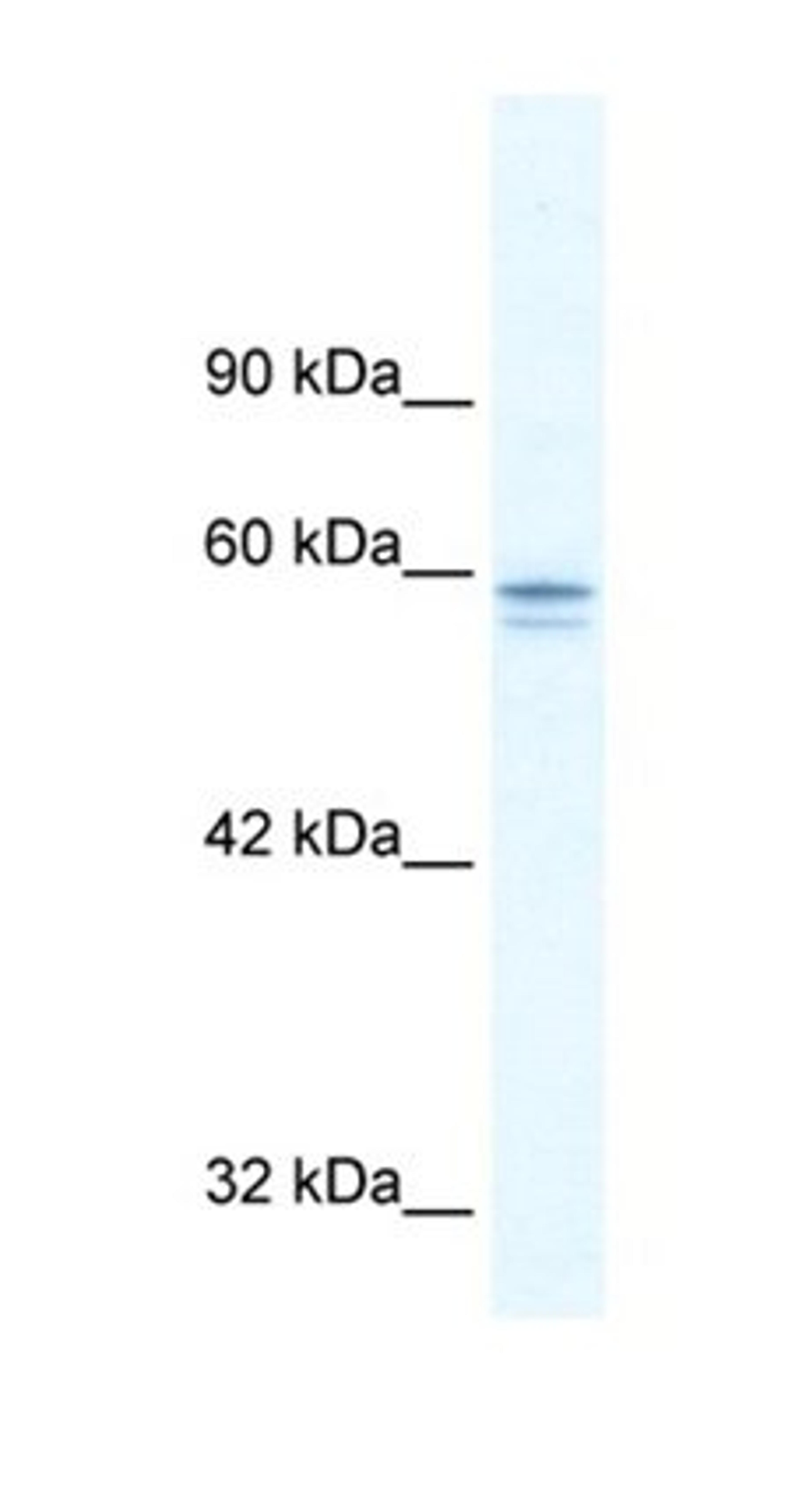 Western blot analysis of HepG2 cell lysate tissue using MTF1 antibody