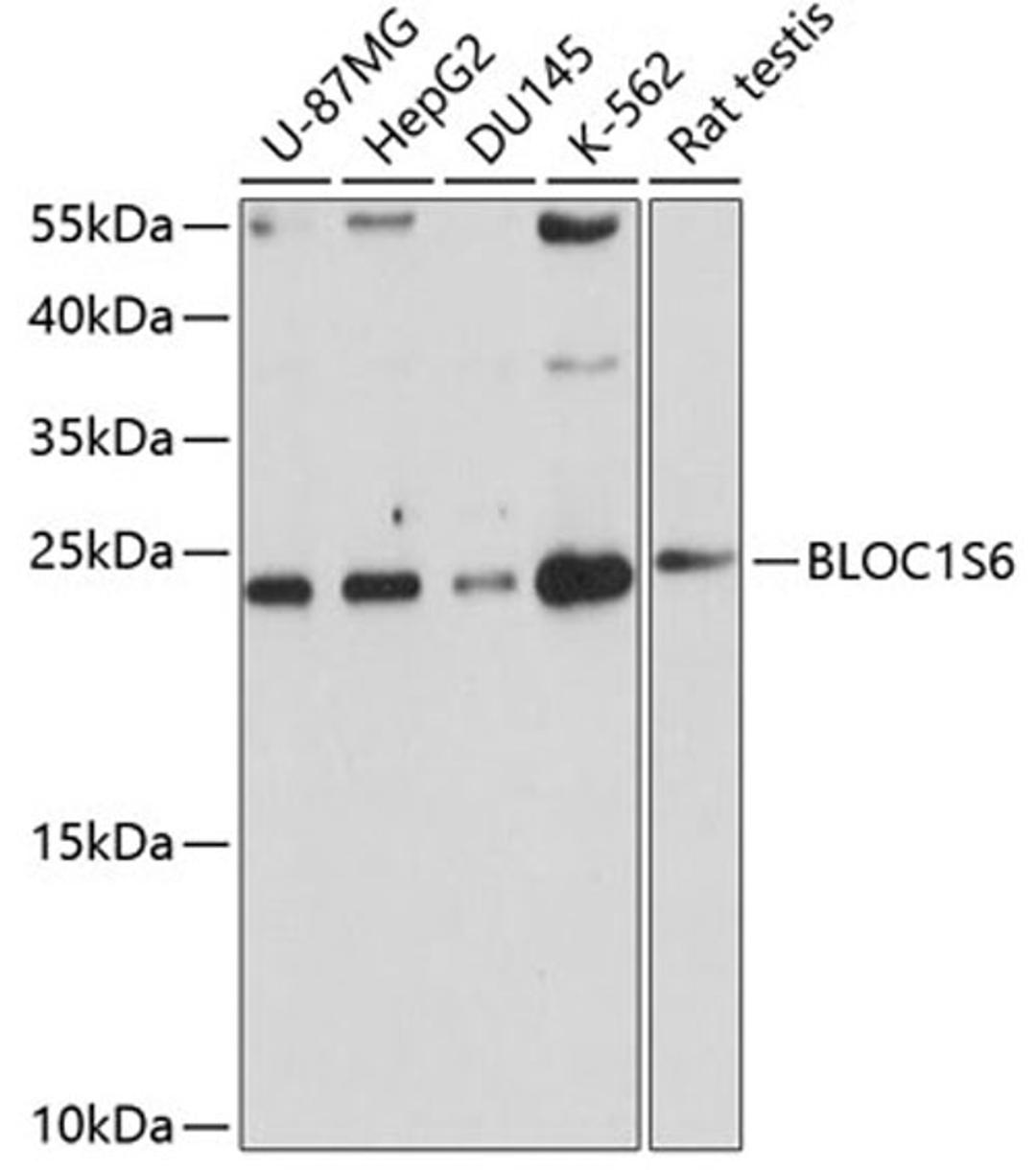 Western blot - BLOC1S6 antibody (A4620)