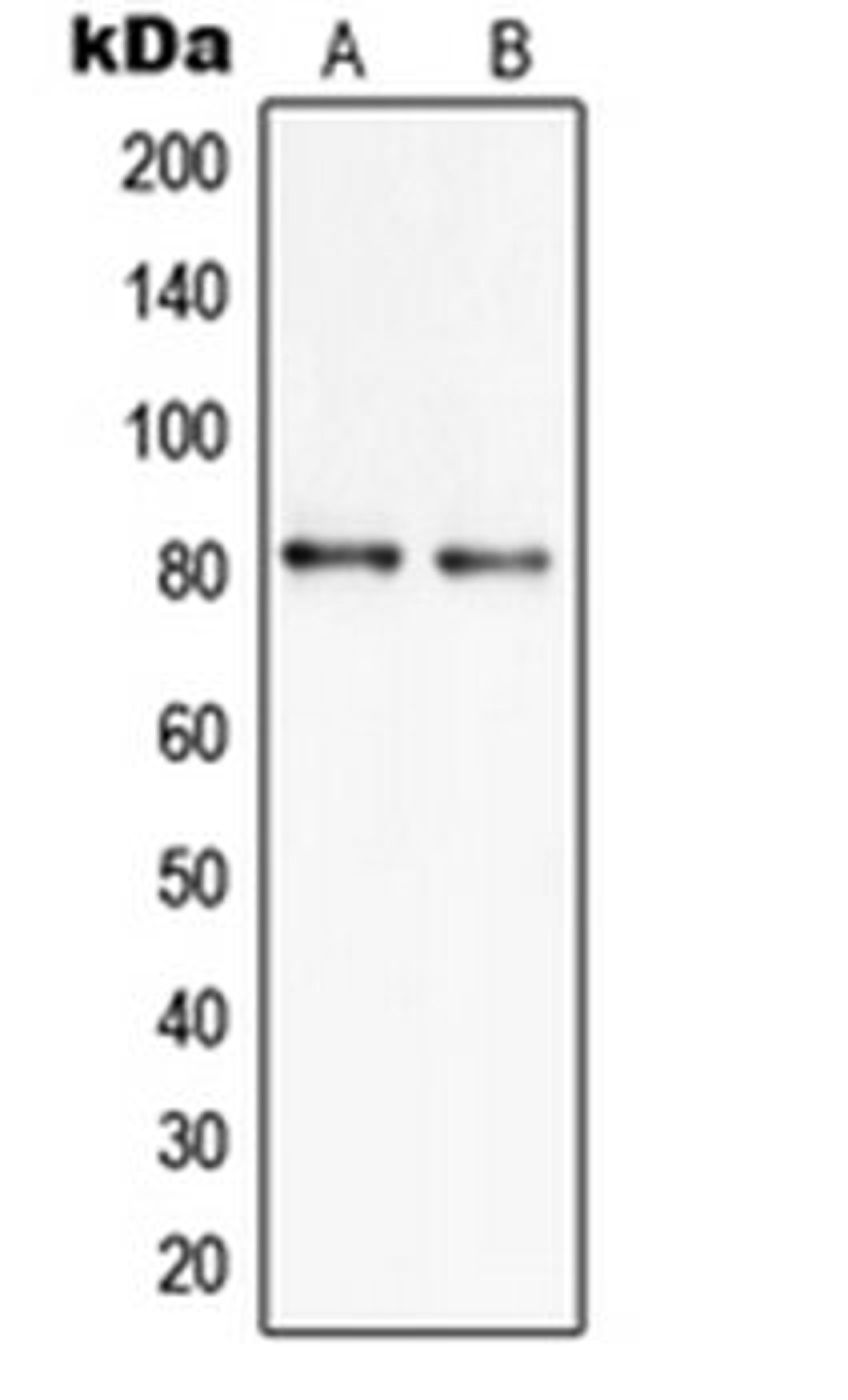 Western blot analysis of NCIH460 (Lane 1), U251MG (Lane 2) whole cell lysates using SLC6A17 antibody