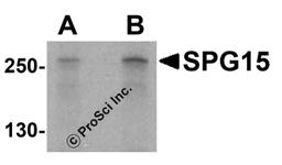 Western blot analysis of SPG15 in K562 cell lysate with SPG15 antibody at (A) 1 and (B) 2 μg/mL.
