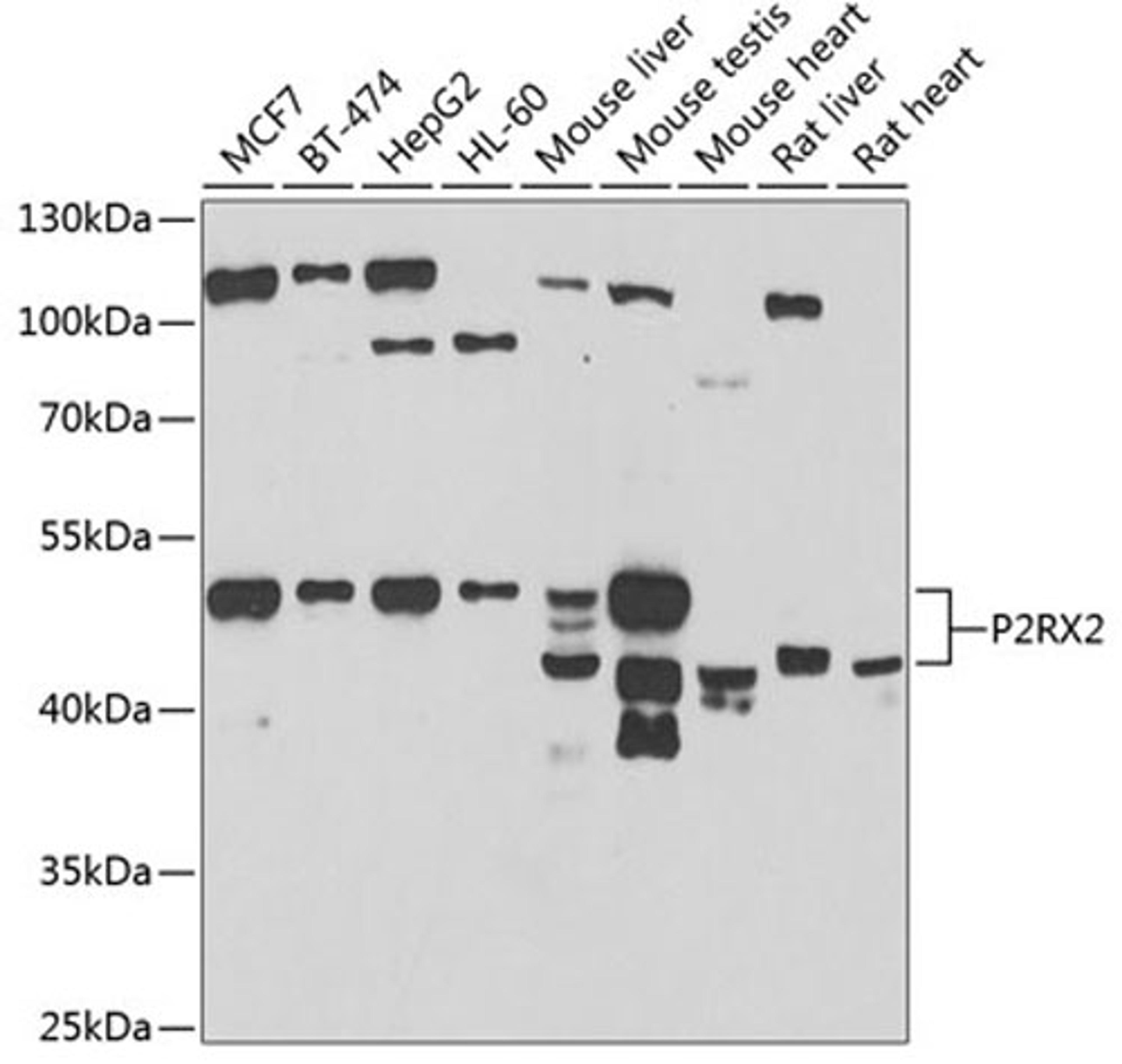 Western blot - P2RX2 antibody (A7078)