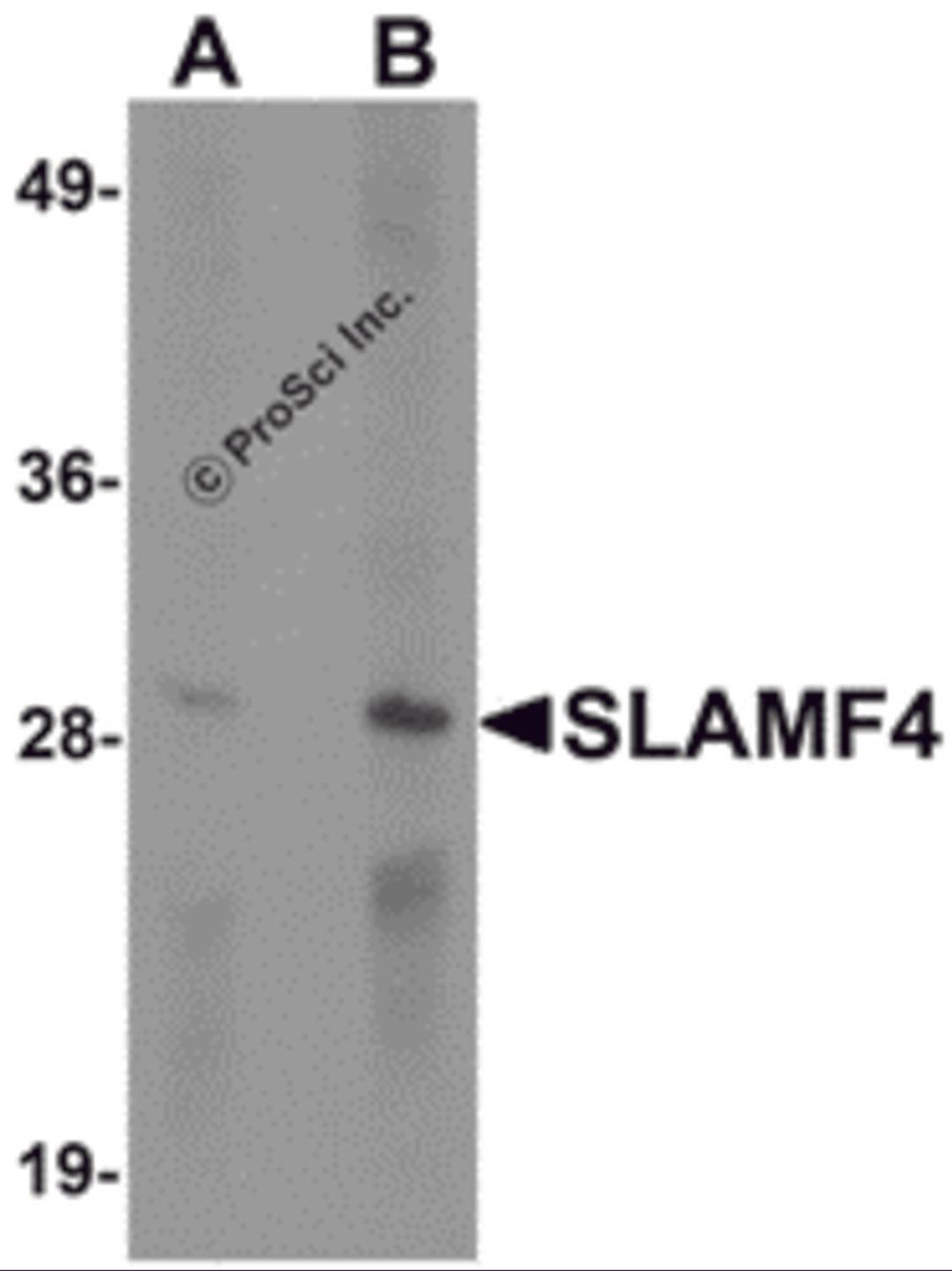 Western blot analysis of SLAMF4 in Daudi cell lysate with SLAMF4 antibody at (A) 1 and (B) 2 μg/mL.