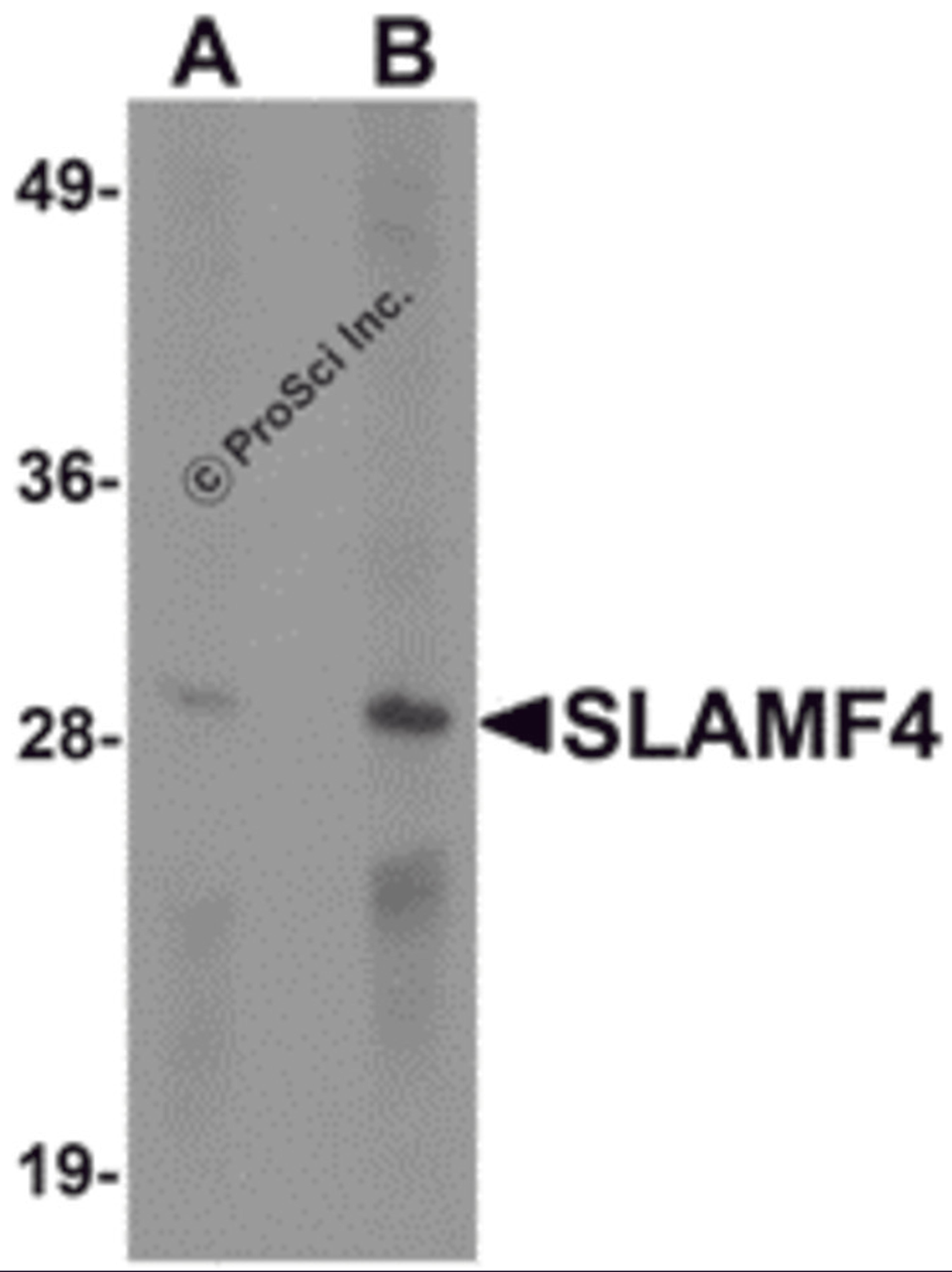 Western blot analysis of SLAMF4 in Daudi cell lysate with SLAMF4 antibody at (A) 1 and (B) 2 μg/mL.