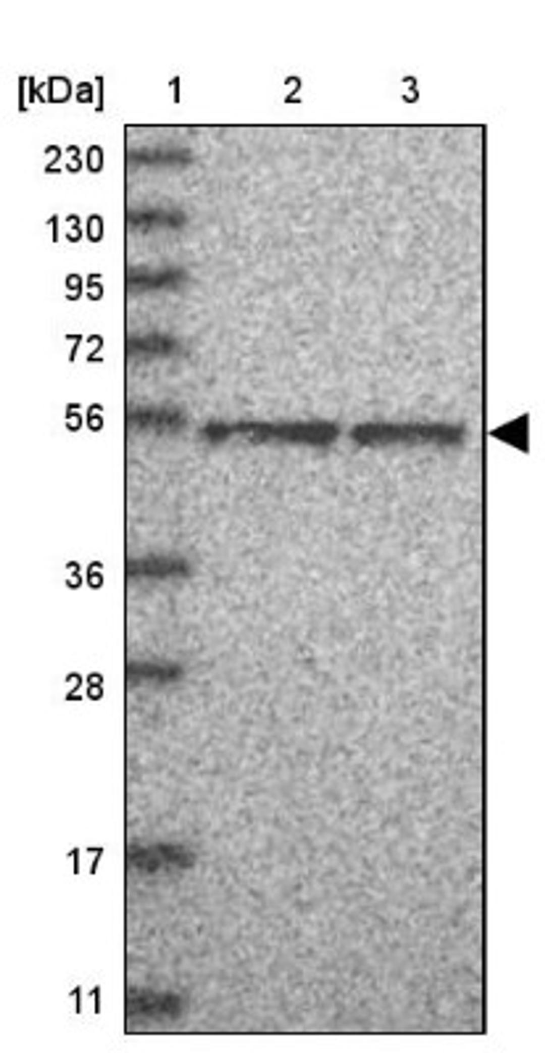 Western Blot: TFCP2L1 Antibody [NBP1-85441] - Lane 1: Marker [kDa] 230, 130, 95, 72, 56, 36, 28, 17, 11<br/>Lane 2: Human cell line RT-4<br/>Lane 3: Human cell line U-251MG sp