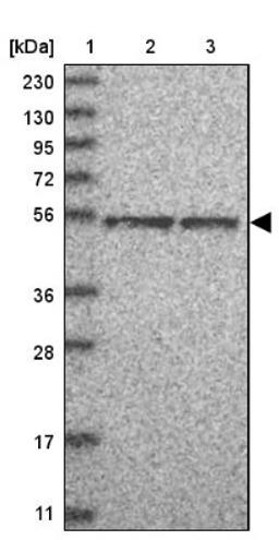 Western Blot: TFCP2L1 Antibody [NBP1-85441] - Lane 1: Marker [kDa] 230, 130, 95, 72, 56, 36, 28, 17, 11<br/>Lane 2: Human cell line RT-4<br/>Lane 3: Human cell line U-251MG sp