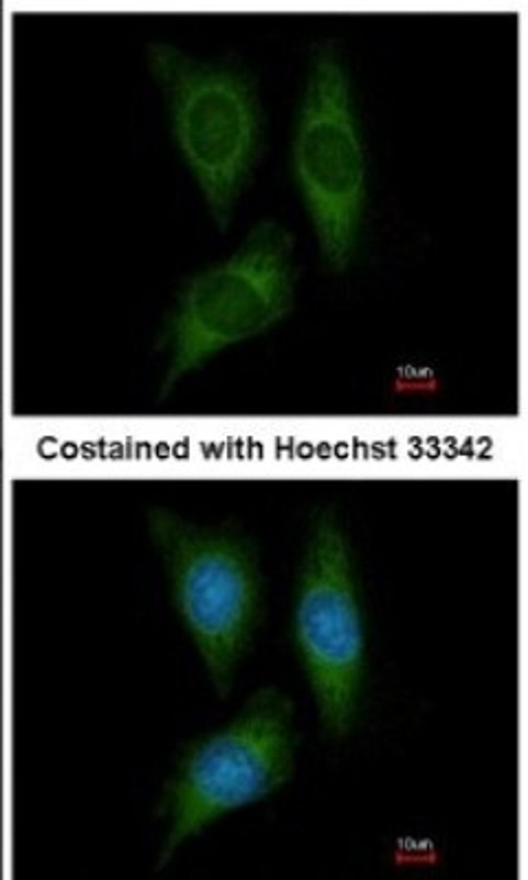 Immunocytochemistry/Immunofluorescence: STK25 Antibody [NBP1-32670] - Analysis of methanol-fixed HeLa, using antibody at 1:200 dilution.