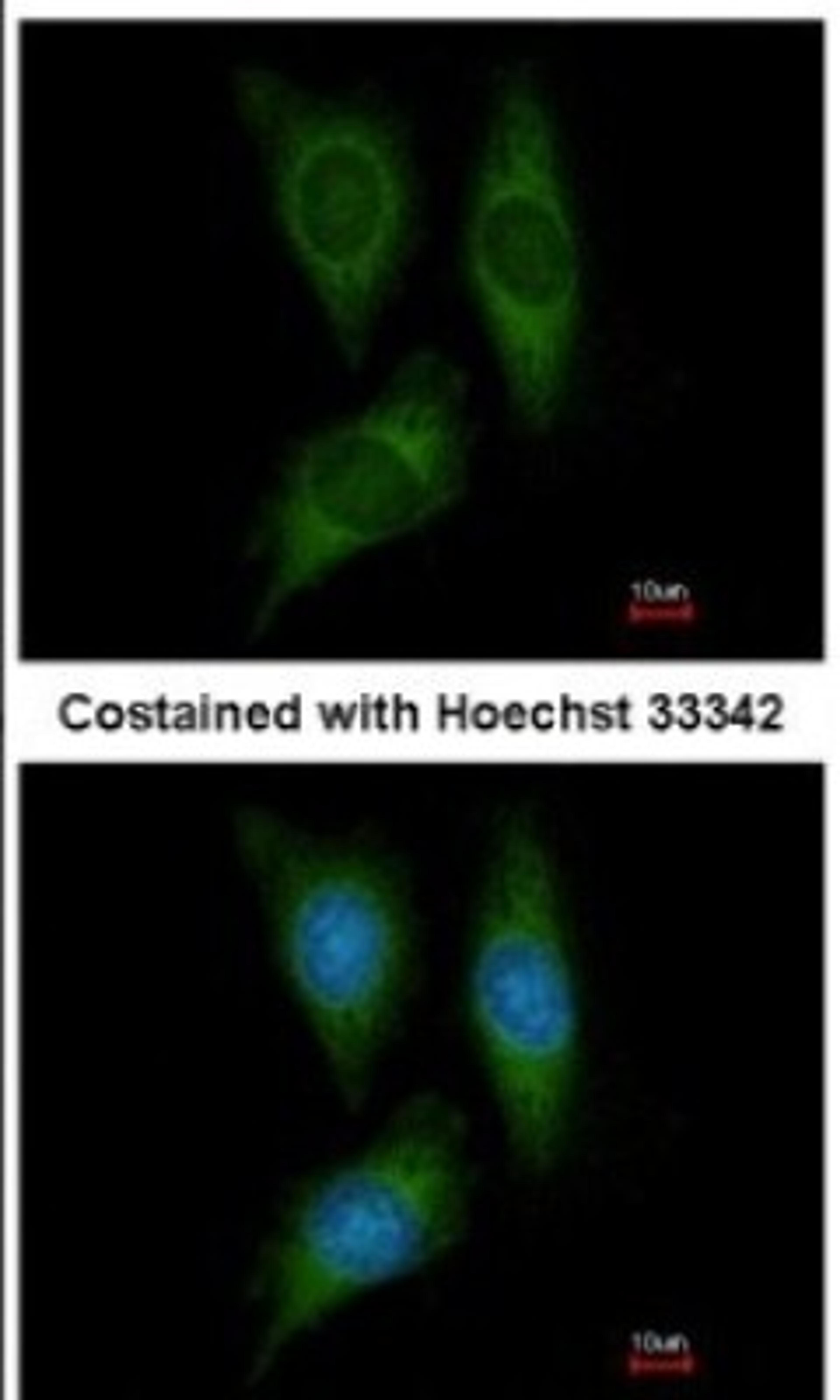 Immunocytochemistry/Immunofluorescence: STK25 Antibody [NBP1-32670] - Analysis of methanol-fixed HeLa, using antibody at 1:200 dilution.