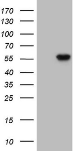 Western Blot: TDG Antibody (3C11) [NBP2-46091] - Analysis of HEK293T cells were transfected with the pCMV6-ENTRY control (Left lane) or pCMV6-ENTRY TDG.