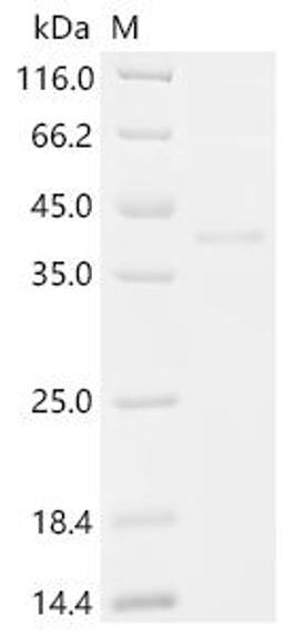 (Tris-Glycine gel) Discontinuous SDS-PAGE (reduced) with 5% enrichment gel and 15% separation gel.
