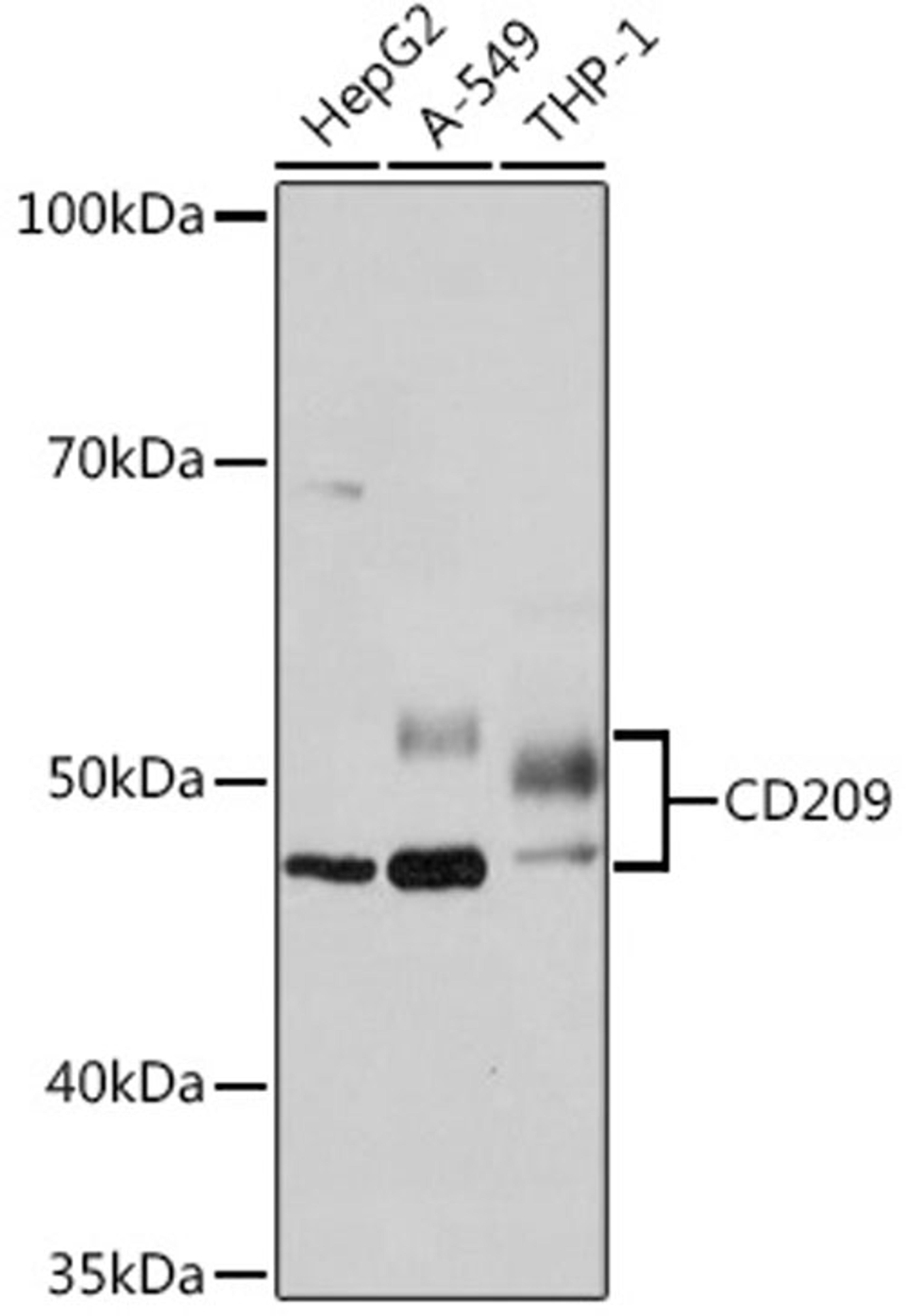 Western blot - CD209 Rabbit mAb (A9649)