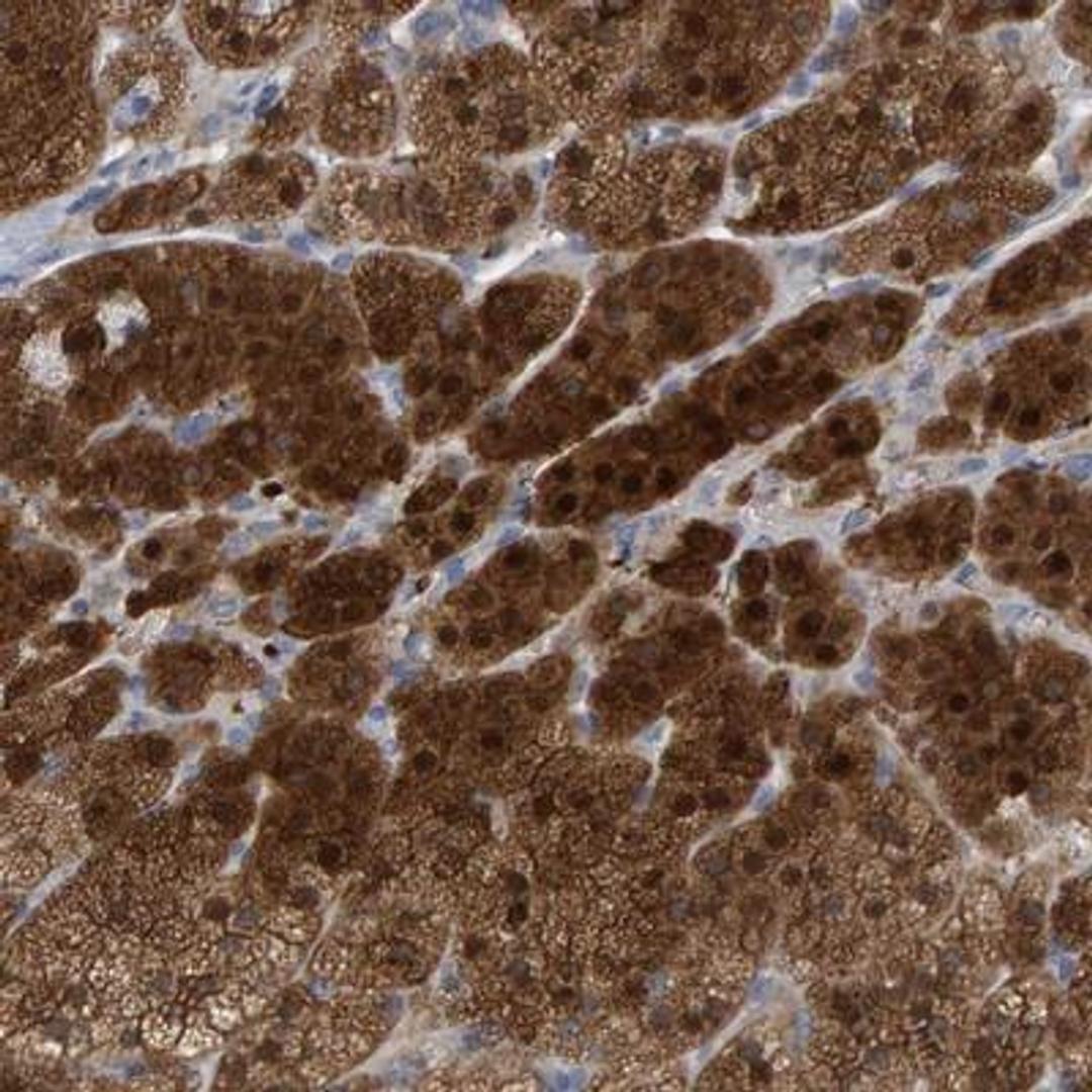 Immunohistochemistry: ALAD Antibody [NBP1-89158] - Staining of human adrenal gland shows strong cytoplasmic and nuclear positivity in cortical cells.