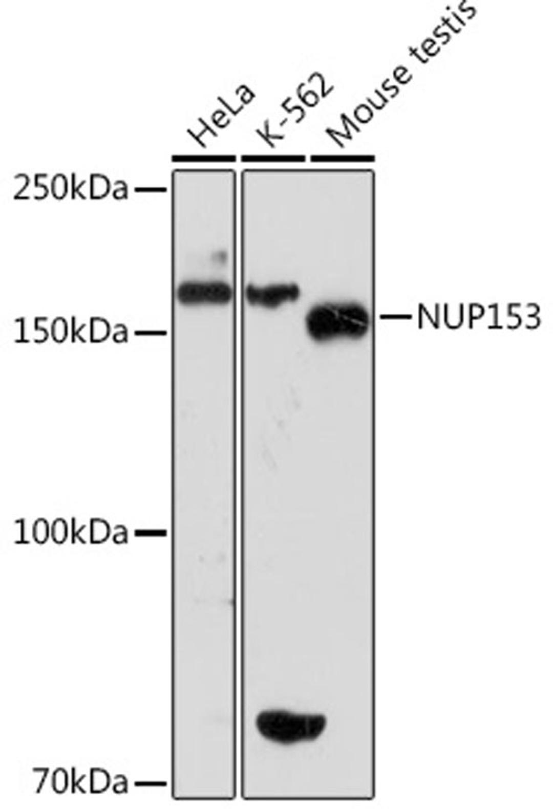 Western blot - NUP153 Rabbit mAb (A2472)