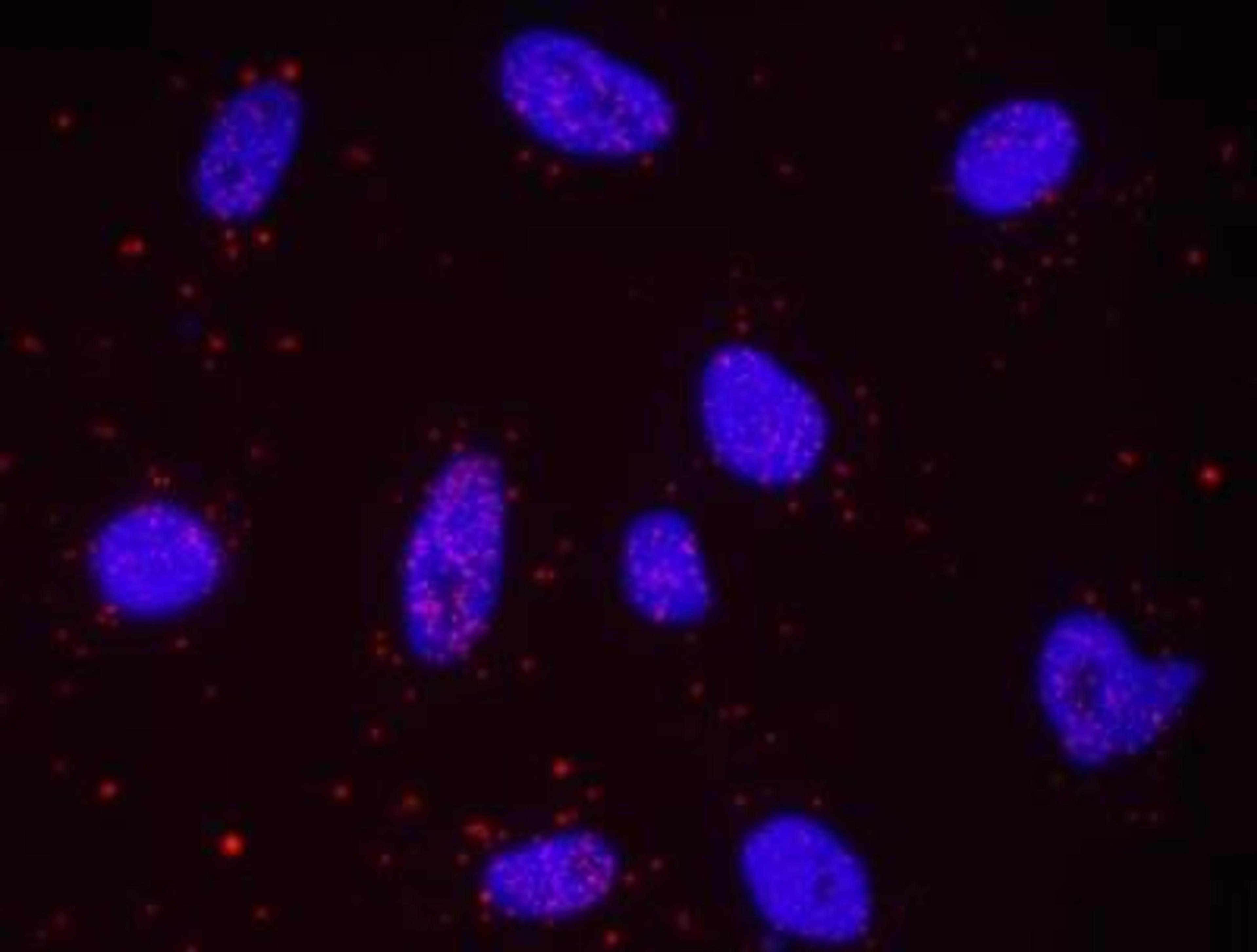 Proximity Ligation Assay: ER alpha/NR3A1 [p Ser305] Antibody [NB100-1567] - Secondary-conjugate Duolink II PLA in Hela cells. goat anti-human SMARCA4 (NBP2-22234) and rabbit anti-human phospho-Estrogen Receptor Alpha  [S305] (NB100-1567). Image merged from DAPI (2ms) and Texas Red (200ms) exposures, 40X magnification.