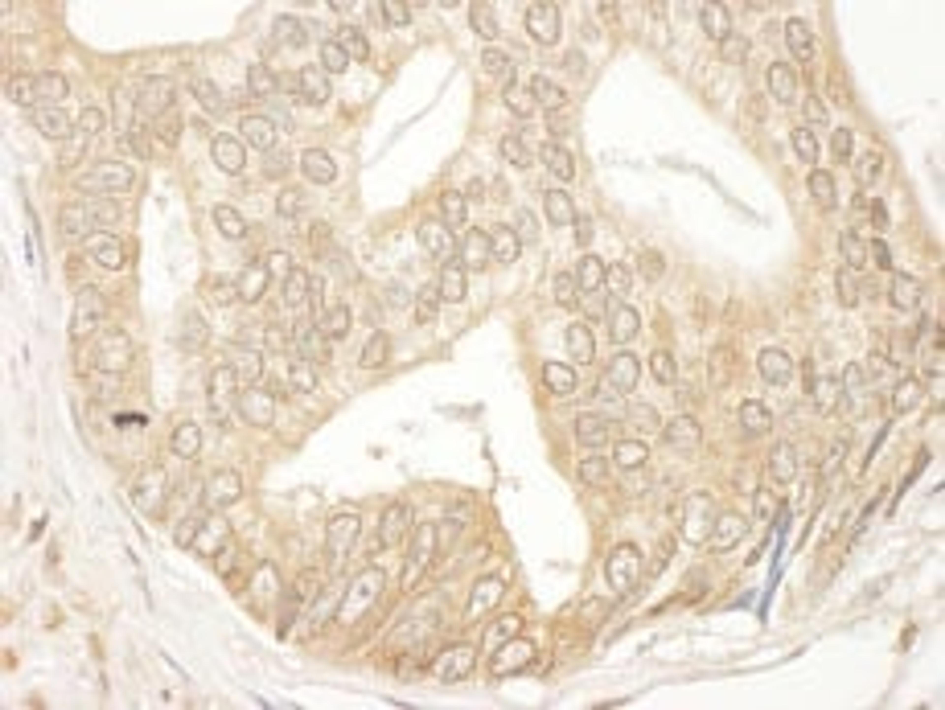 Detection of human MEK2 by immunohistochemistry.