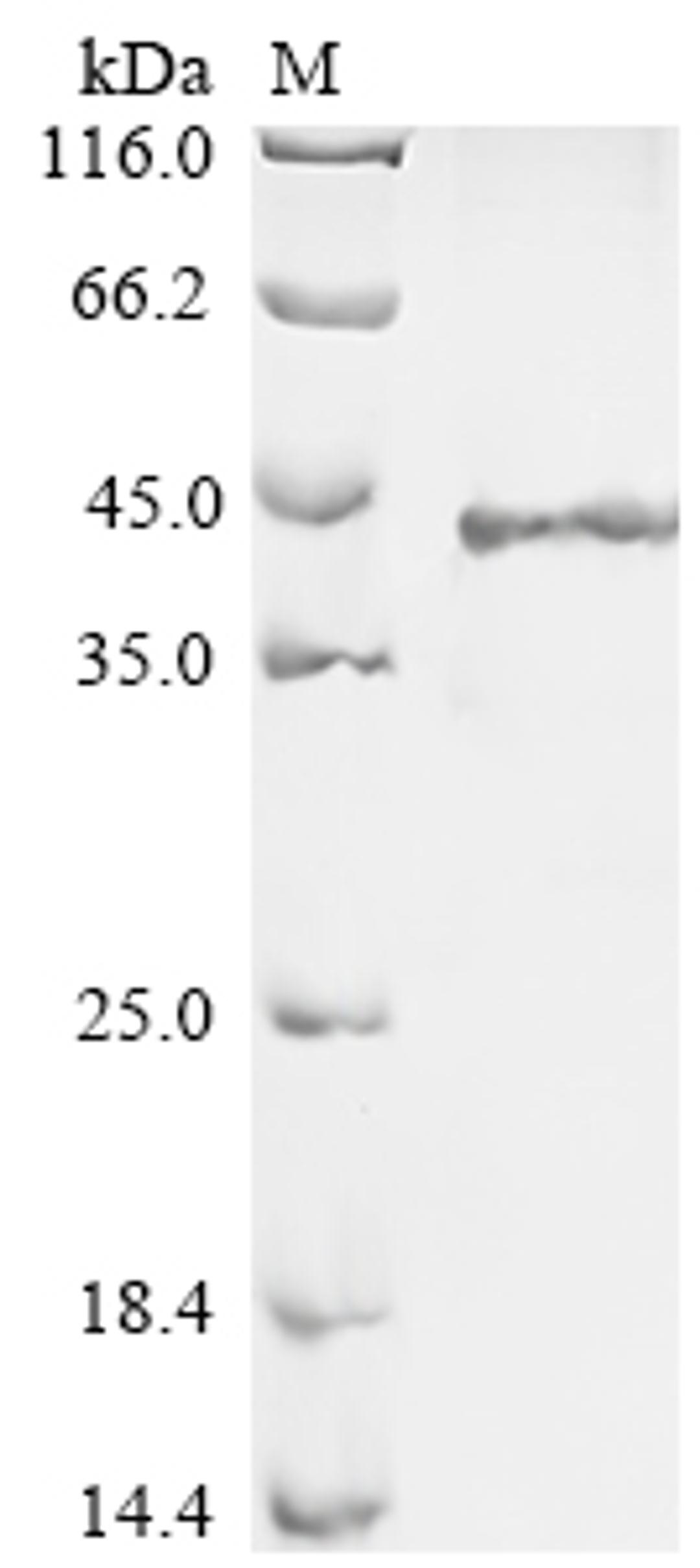 (Tris-Glycine gel) Discontinuous SDS-PAGE (reduced) with 5% enrichment gel and 15% separation gel.