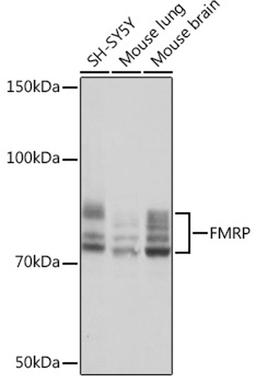 Western blot - FMRP Rabbit mAb (A4539)