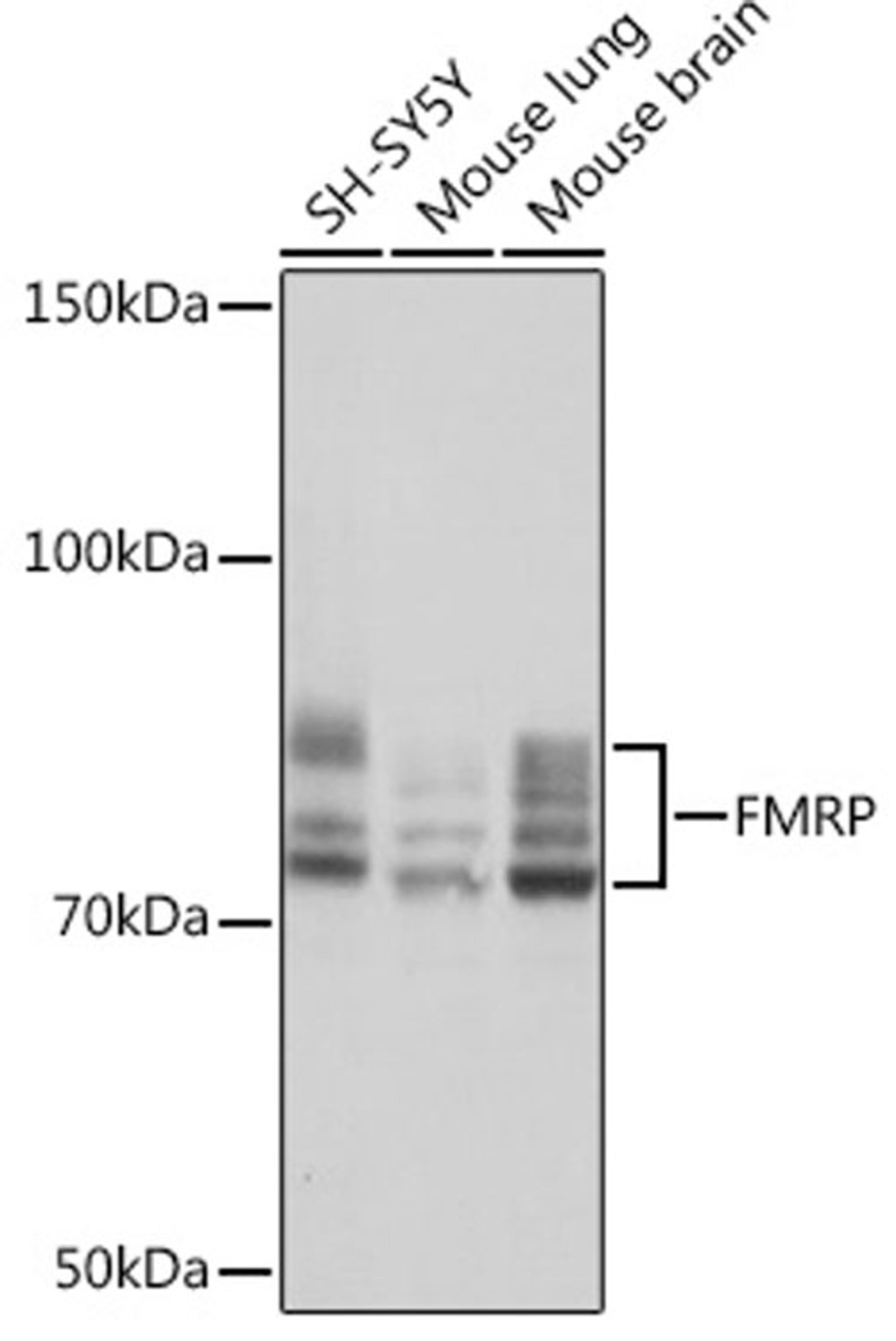 Western blot - FMRP Rabbit mAb (A4539)