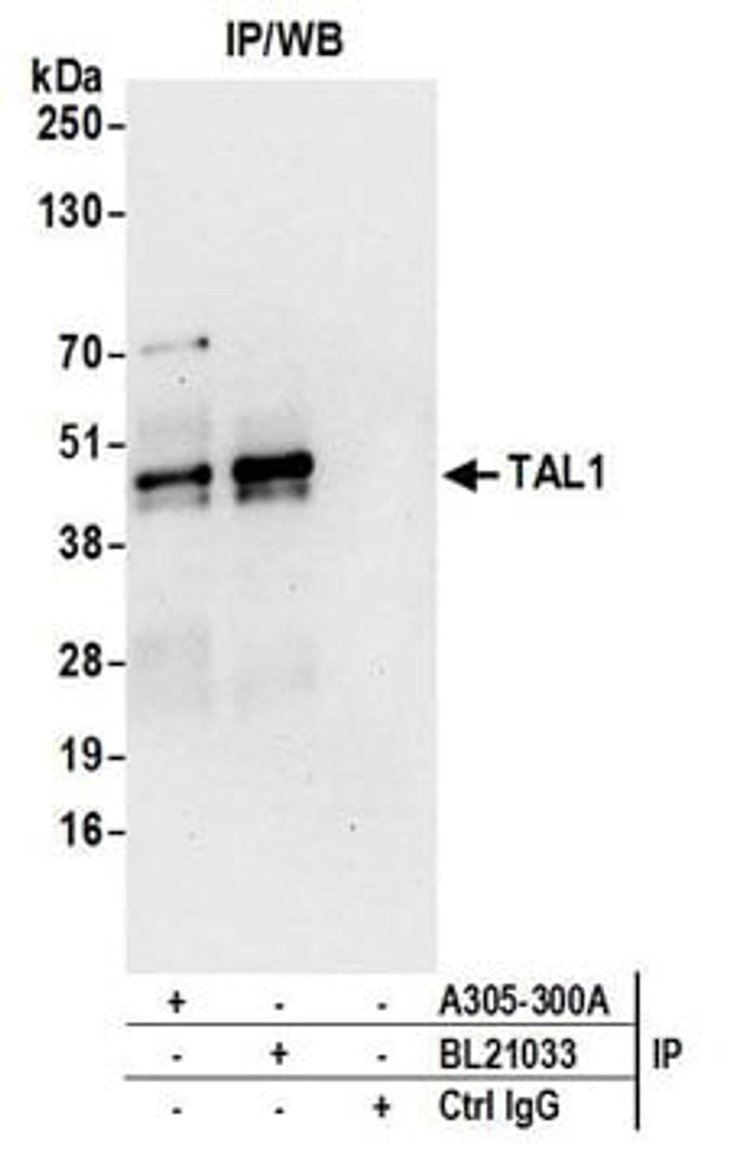 Detection of human TAL1 by western blot of immunoprecipitates.