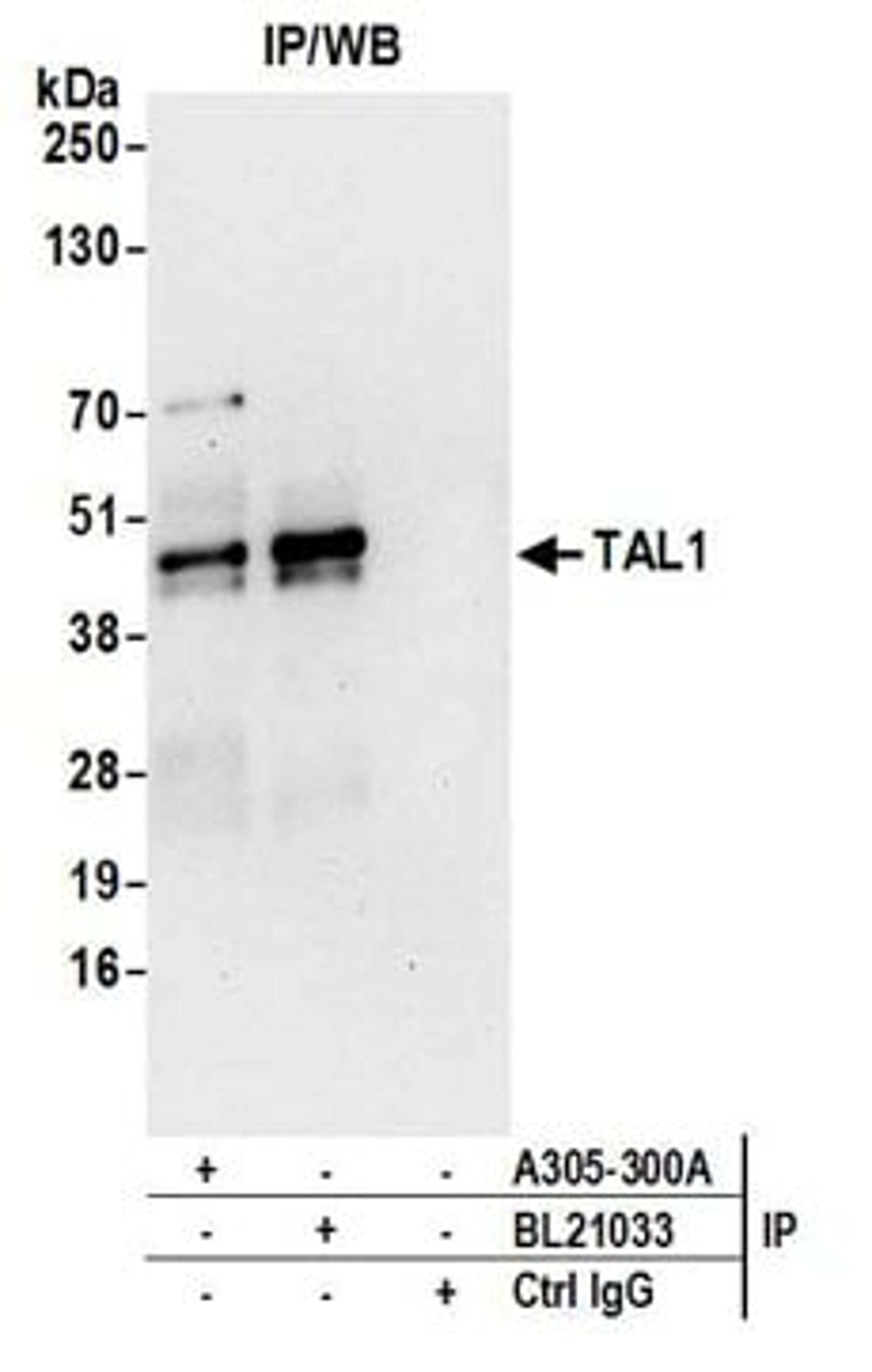 Detection of human TAL1 by western blot of immunoprecipitates.