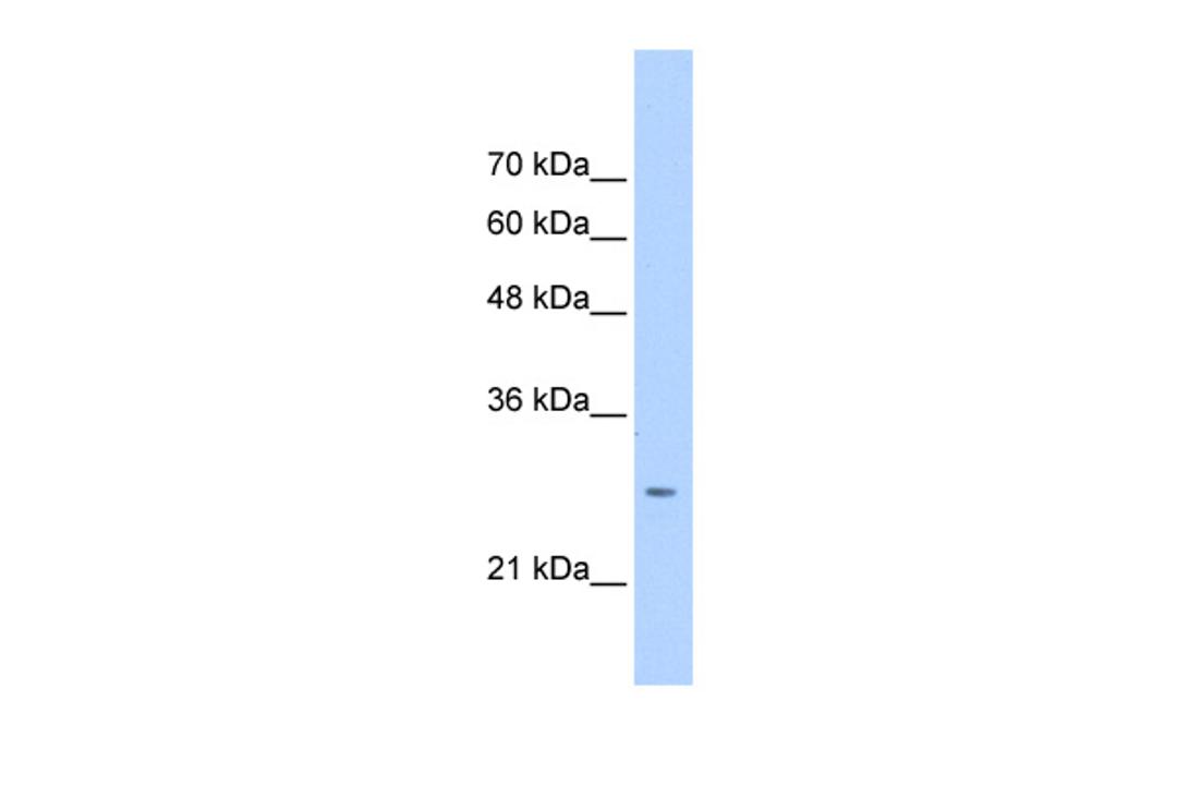 Antibody used in WB on Human HepG2 at 0.2-1 ug/ml.