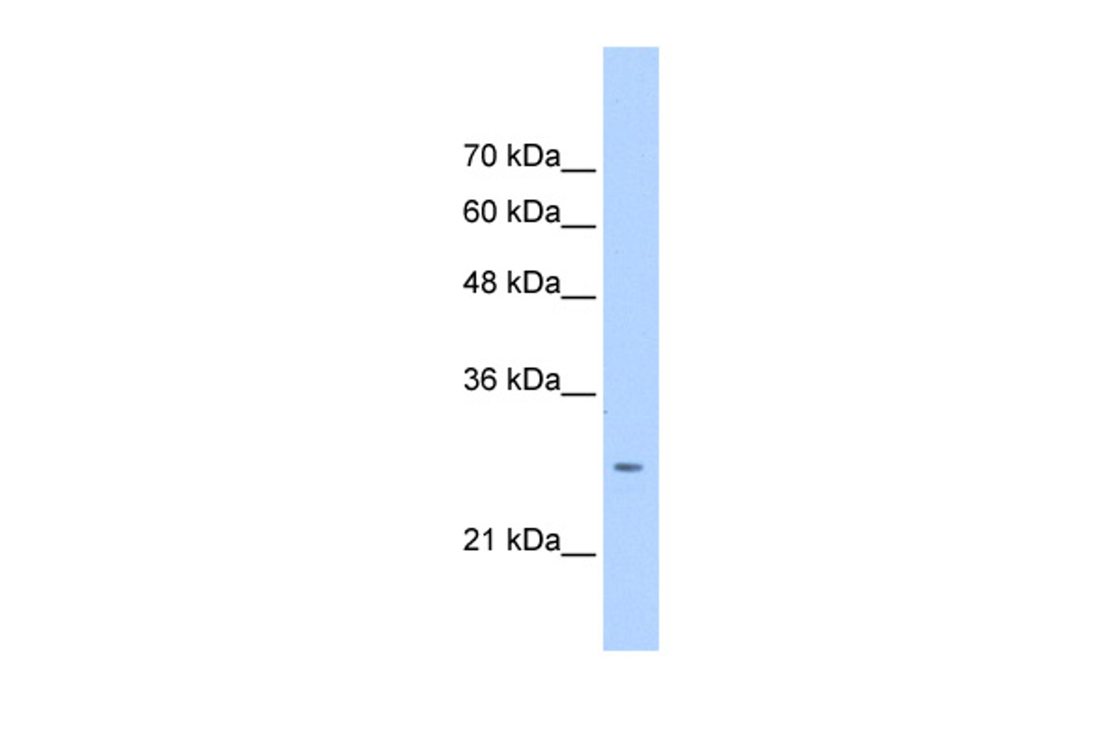 Antibody used in WB on Human HepG2 at 0.2-1 ug/ml.