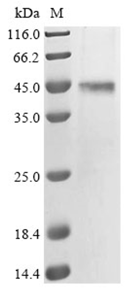 (Tris-Glycine gel) Discontinuous SDS-PAGE (reduced) with 5% enrichment gel and 15% separation gel.
