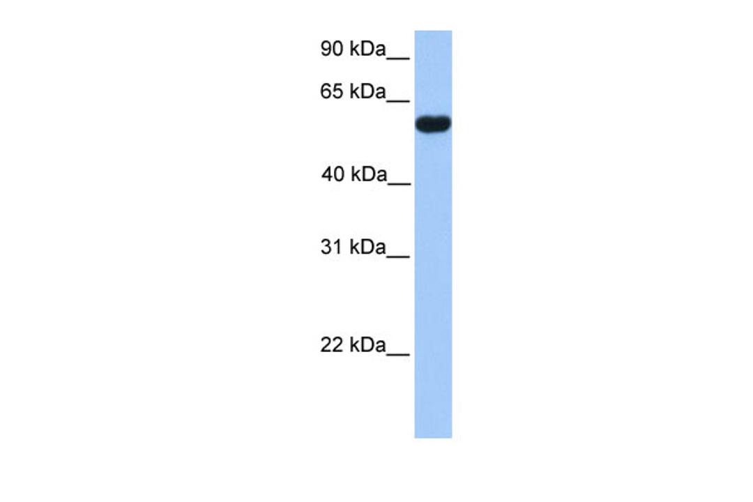 Antibody used in WB on Human Placenta at 0.2-1 ug/ml.