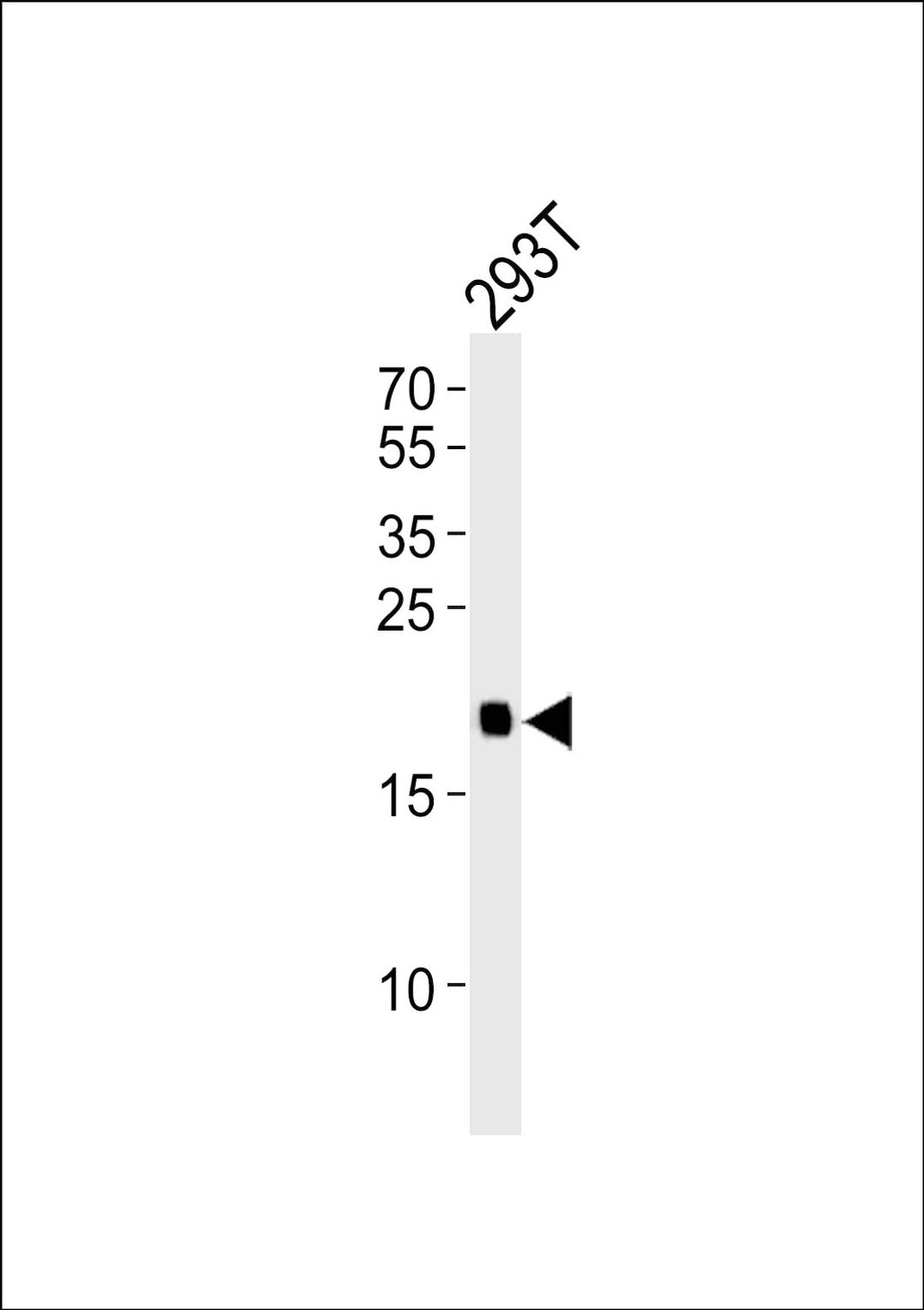 Western blot analysis of lysate from 293T cell line, using HRAS Antibody at 1:1000.