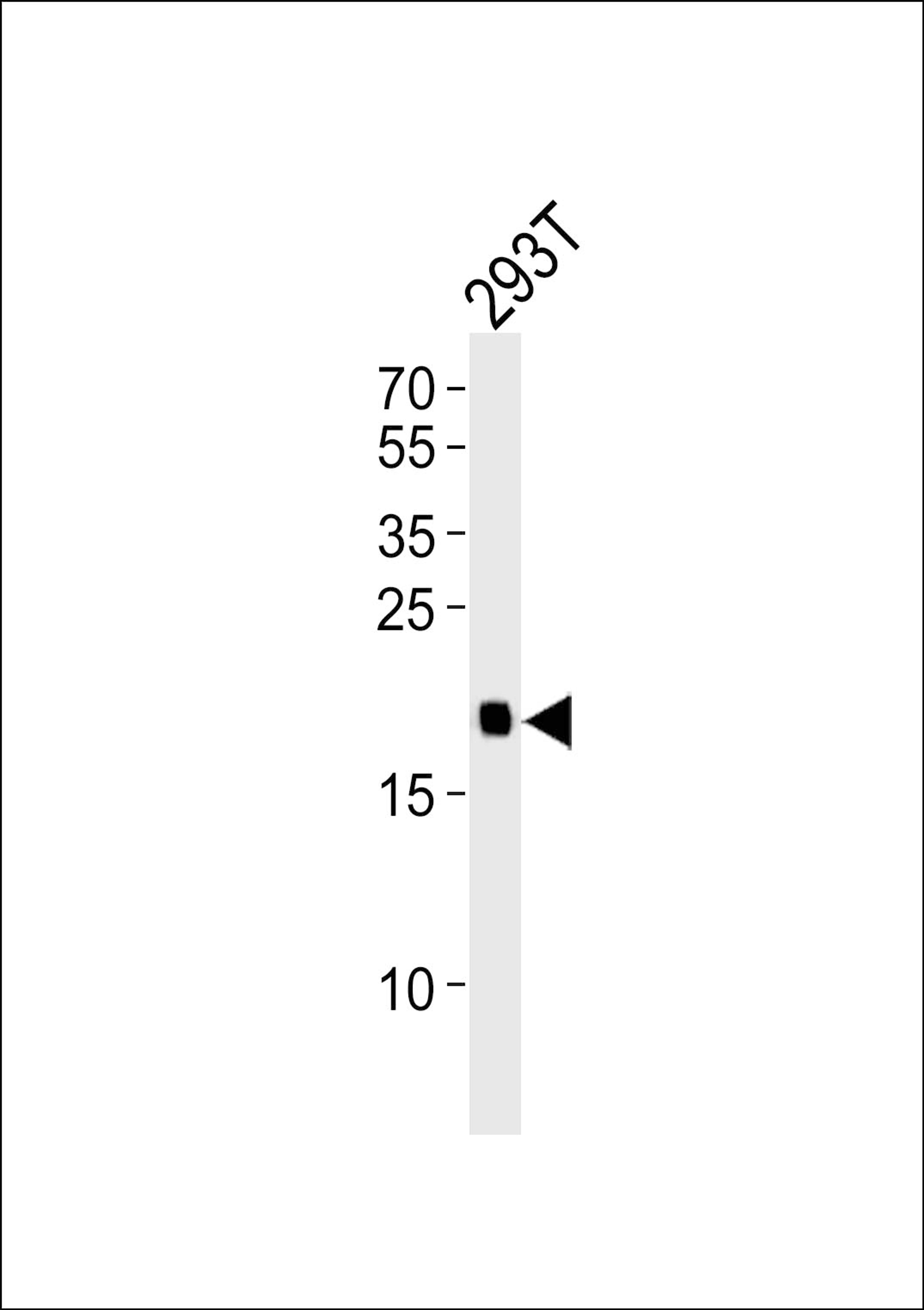 Western blot analysis of lysate from 293T cell line, using HRAS Antibody at 1:1000.