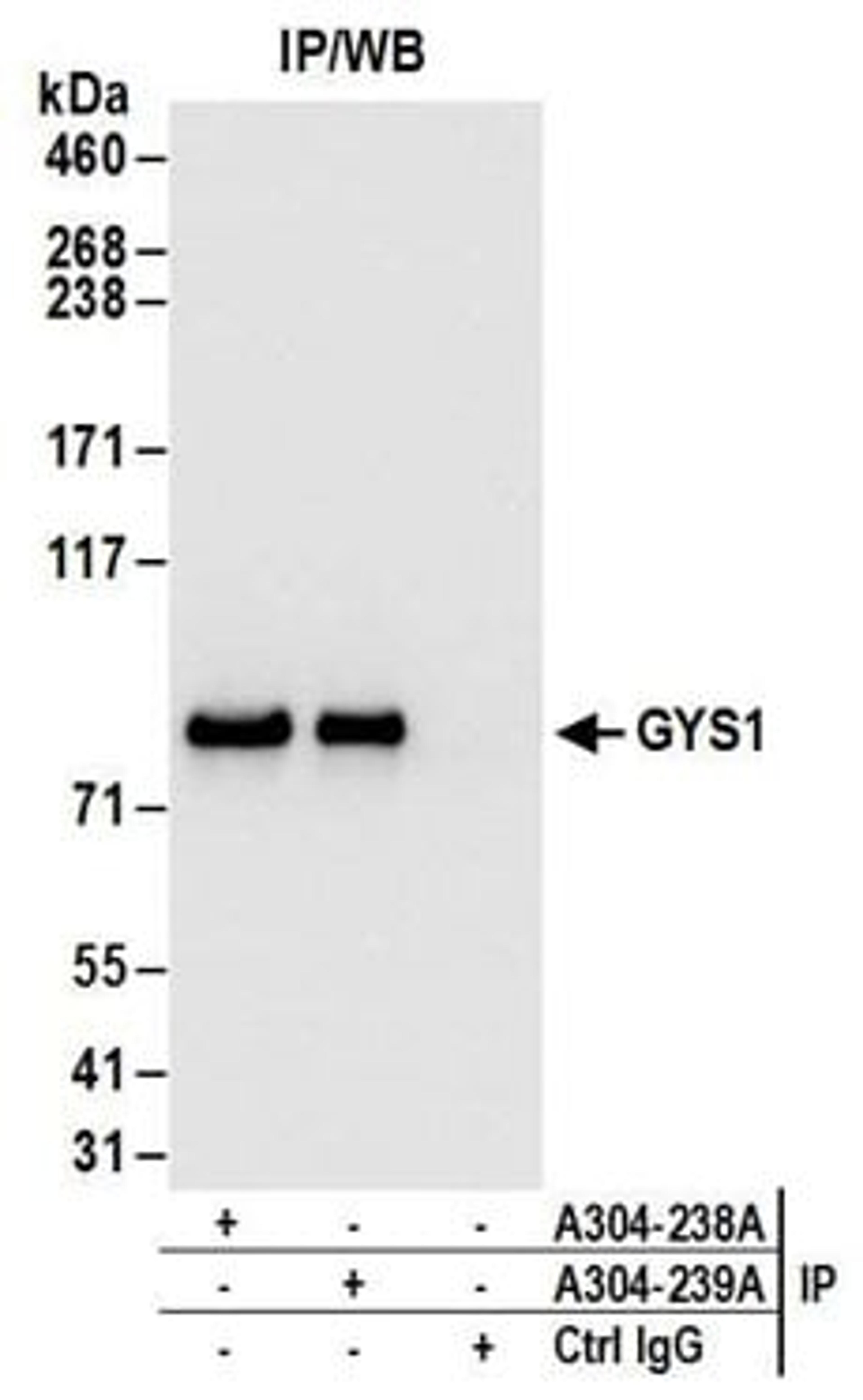 Detection of human GYS1 by western blot of immunoprecipitates.