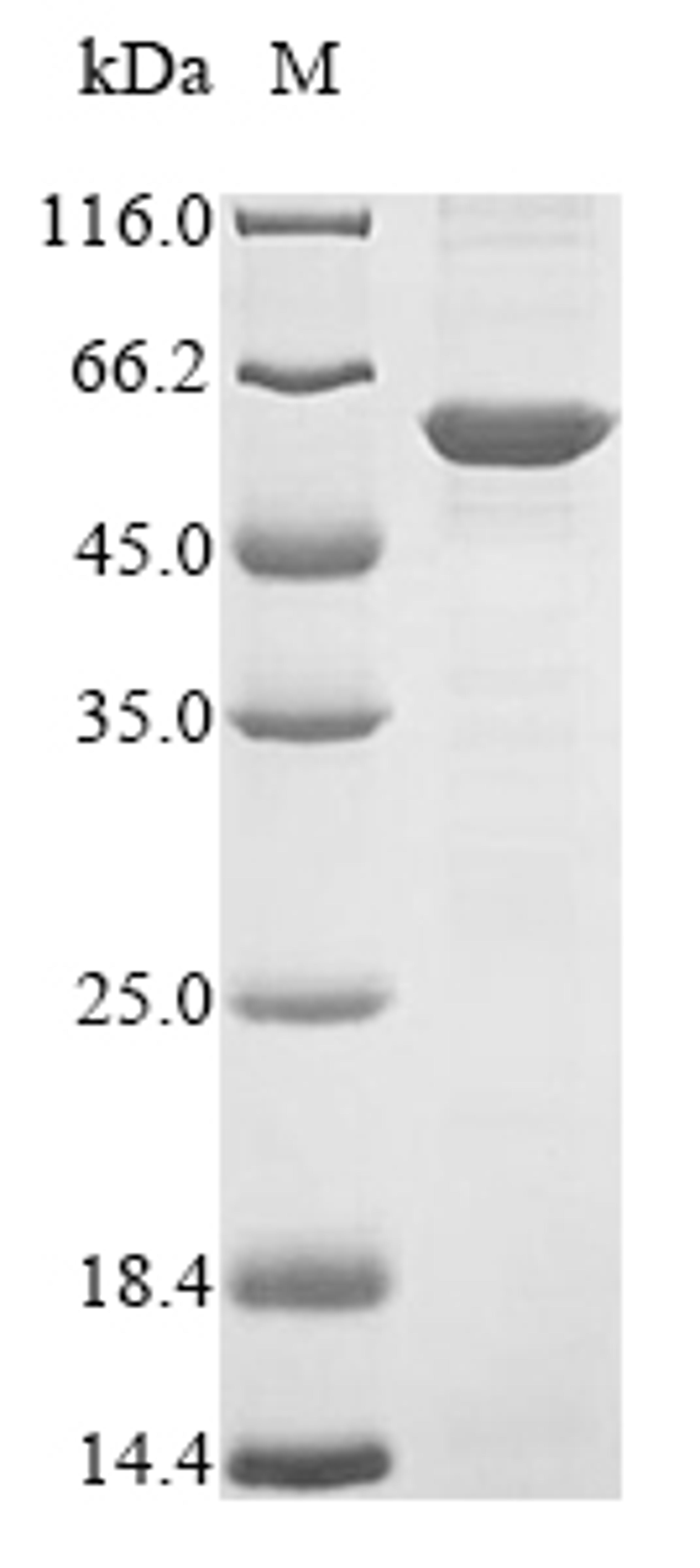 (Tris-Glycine gel) Discontinuous SDS-PAGE (reduced) with 5% enrichment gel and 15% separation gel.