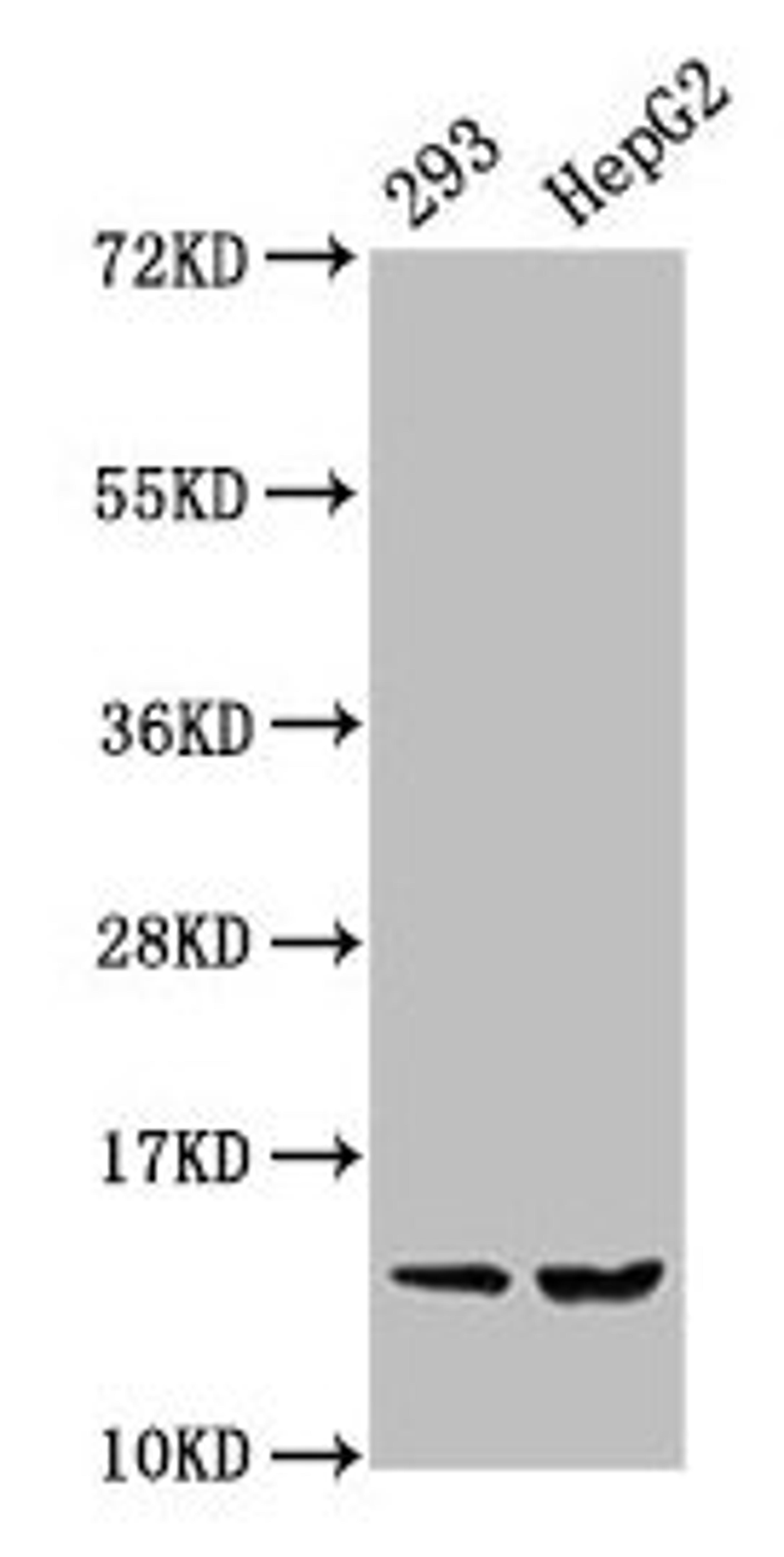 Western Blot. Positive WB detected in: 293 whole cell lysate, HepG2 whole cell lysate. All lanes: HIST1H2BC antibody at 0.36µg/ml. Secondary. Goat polyclonal to rabbit IgG at 1/50000 dilution. Predicted band size: 14 kDa. Observed band size: 14 kDa
