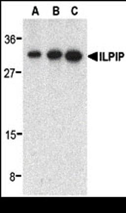 Western blot analysis of ILPIP in human heart lysate with ILPIP antibody at 0.5 (lane A), 1 (lane B), and 2 (lane C) &#956;g/mL, respectively. 