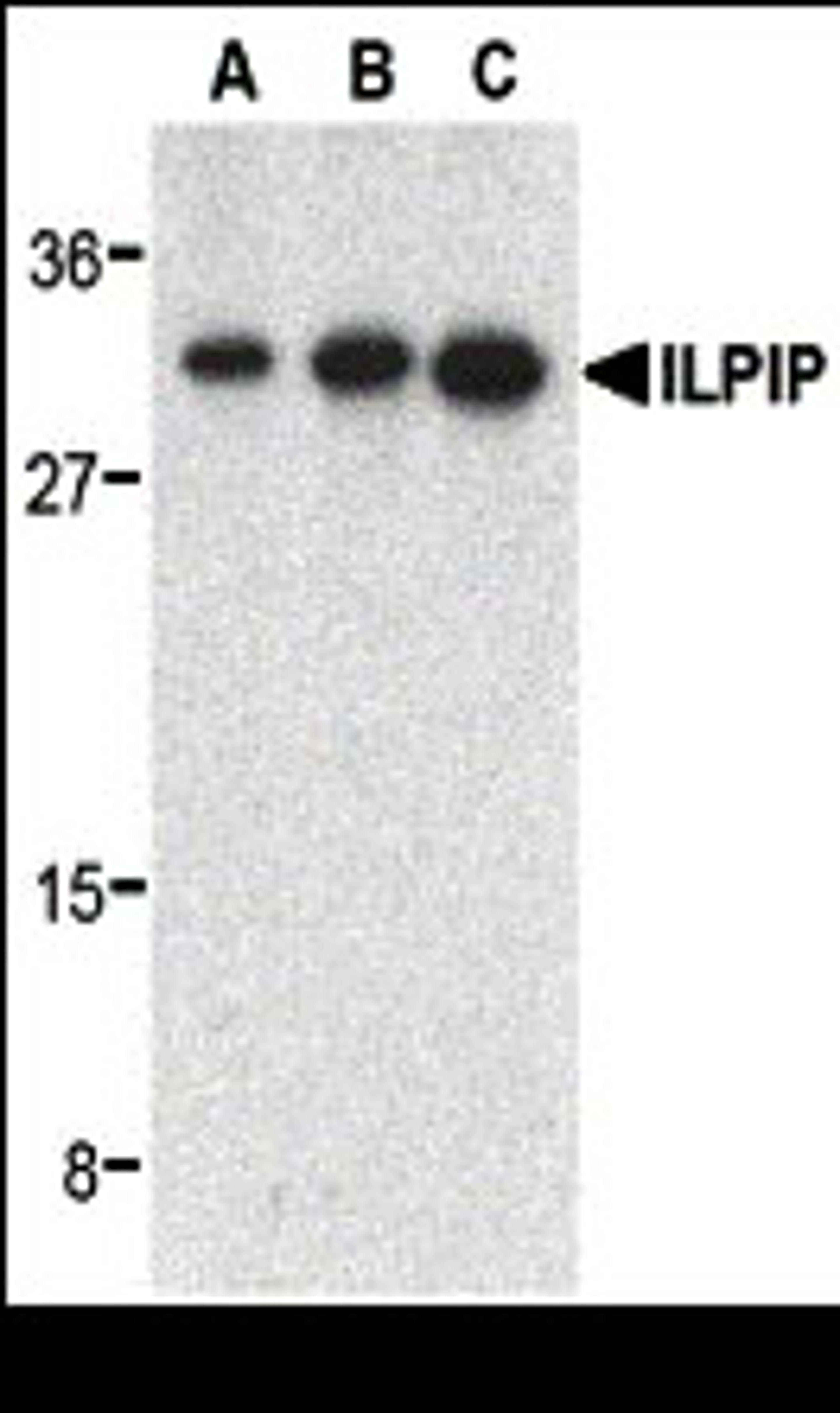 Western blot analysis of ILPIP in human heart lysate with ILPIP antibody at 0.5 (lane A), 1 (lane B), and 2 (lane C) &#956;g/mL, respectively. 