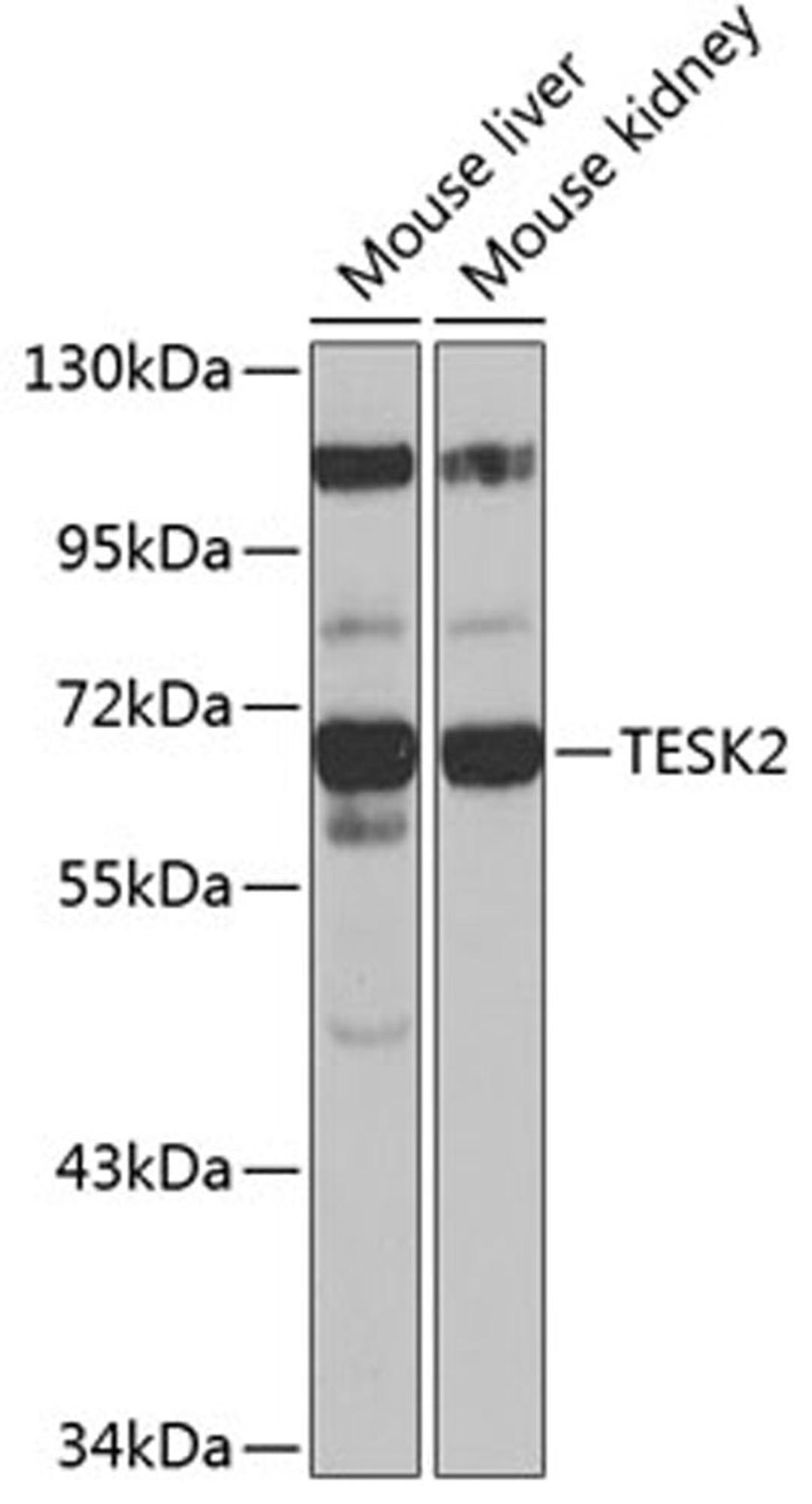 Western blot - TESK2 antibody (A13395)