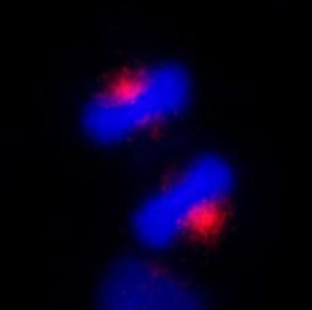 Detection of human CEP170 by immunocytochemistry.