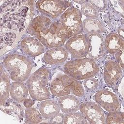 Immunohistochemistry: Vanin-1/VNN1 Antibody [NBP2-38044] - Staining of human kidney shows moderate cytoplasmic positivity in cells in tubules.