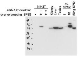 Western blot analysis of NIH3T3 cells lysates using Selenophosphate Synthetase 2 antibody