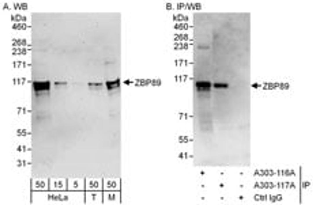 Detection of human and mouse ZBP89 by western blot (h & m) and immunoprecipitation (h).