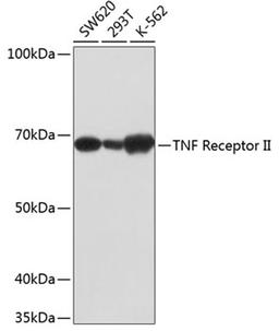 Western blot - TNF Receptor II antibody (A19127)