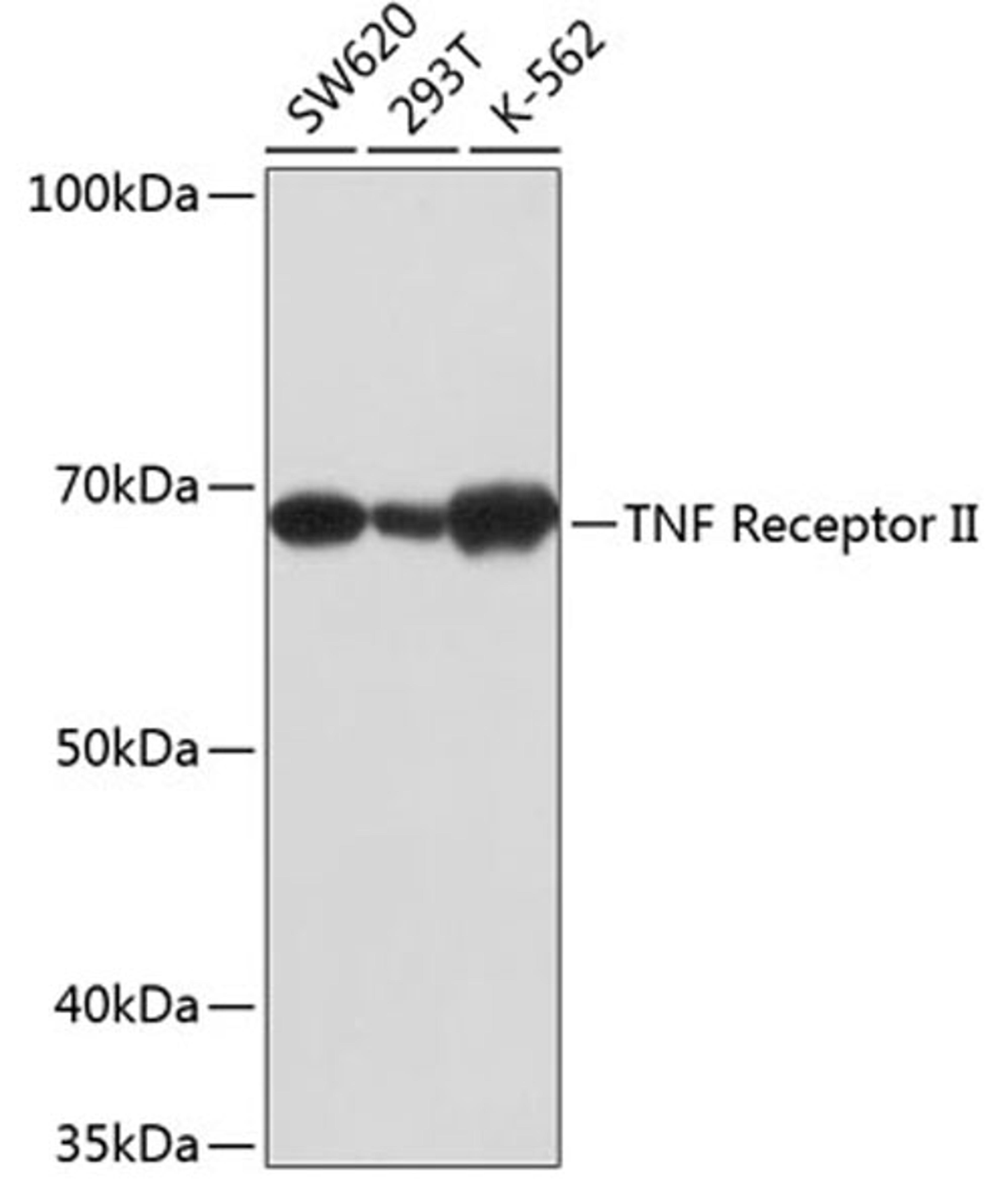 Western blot - TNF Receptor II antibody (A19127)